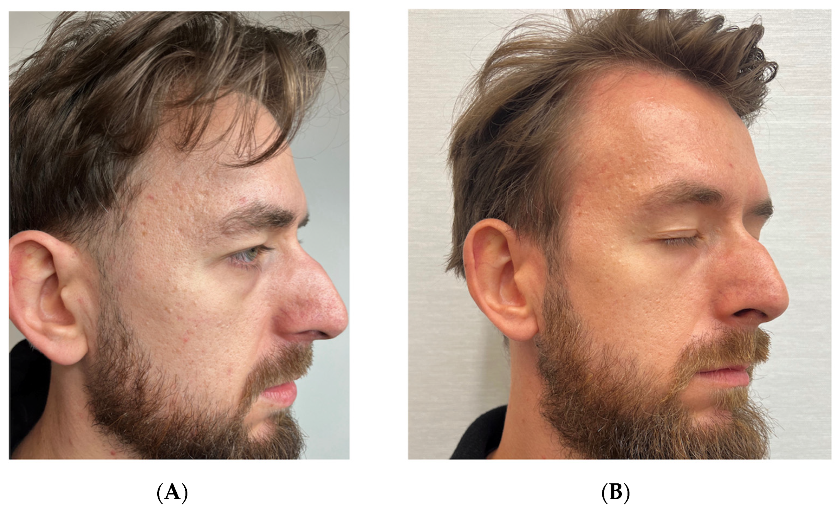 Pharmaceutics 17 00910 g002