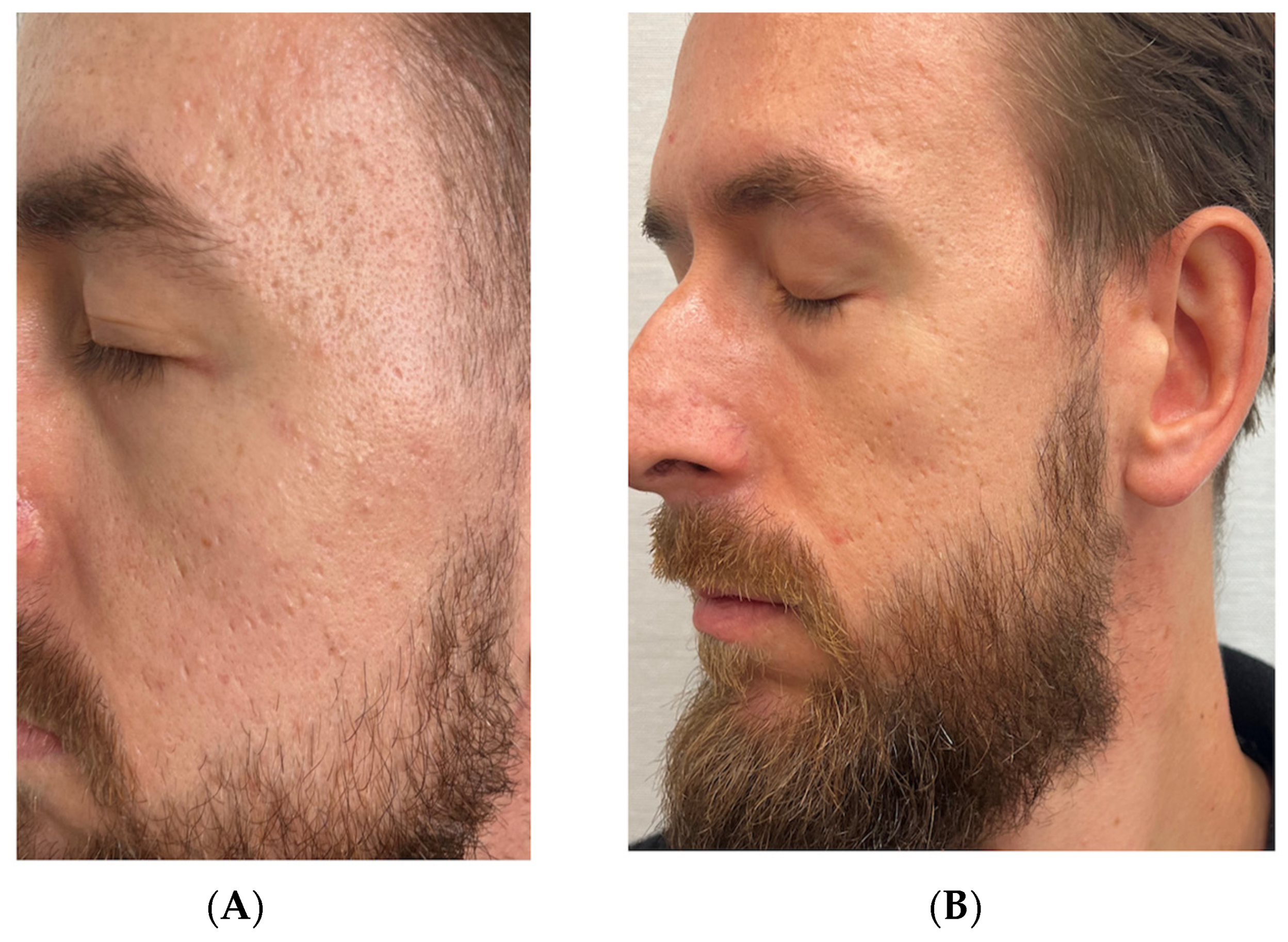 Pharmaceutics 17 00910 g003