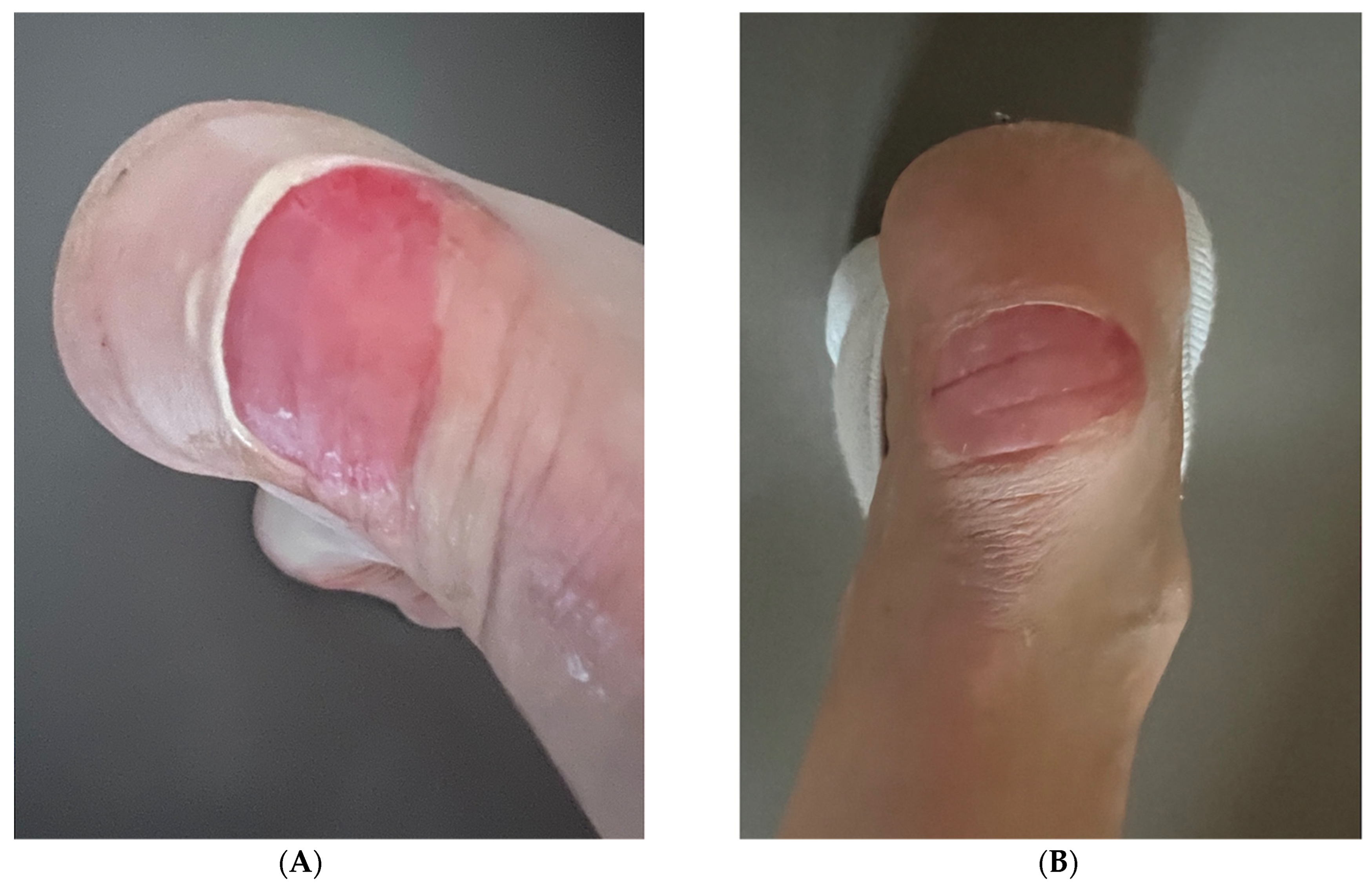 Pharmaceutics 17 00910 g004