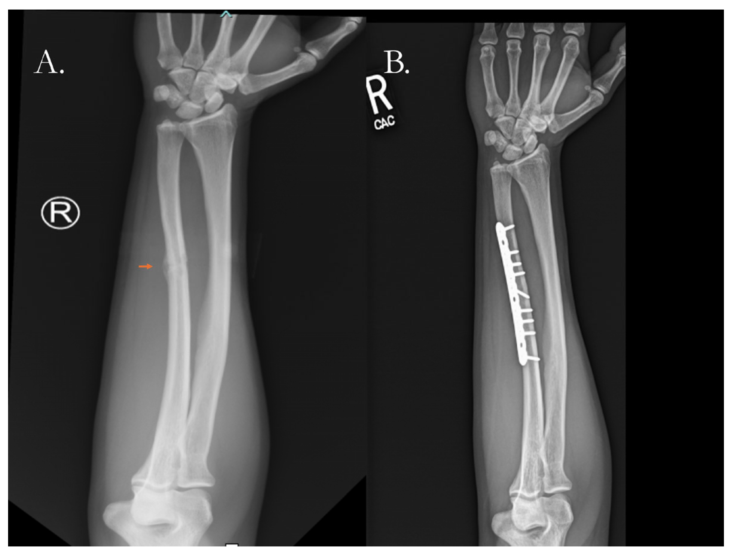 Pharmaceutics 17 01457 g004 Pharmaceutics 17 01457 g004