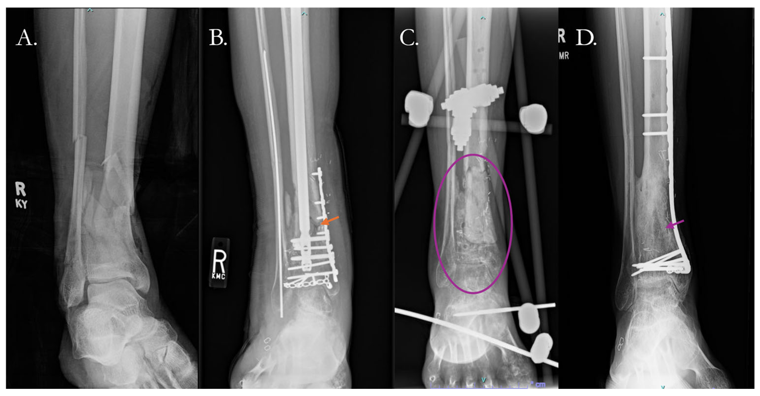 Pharmaceutics 17 01457 g005 Pharmaceutics 17 01457 g005