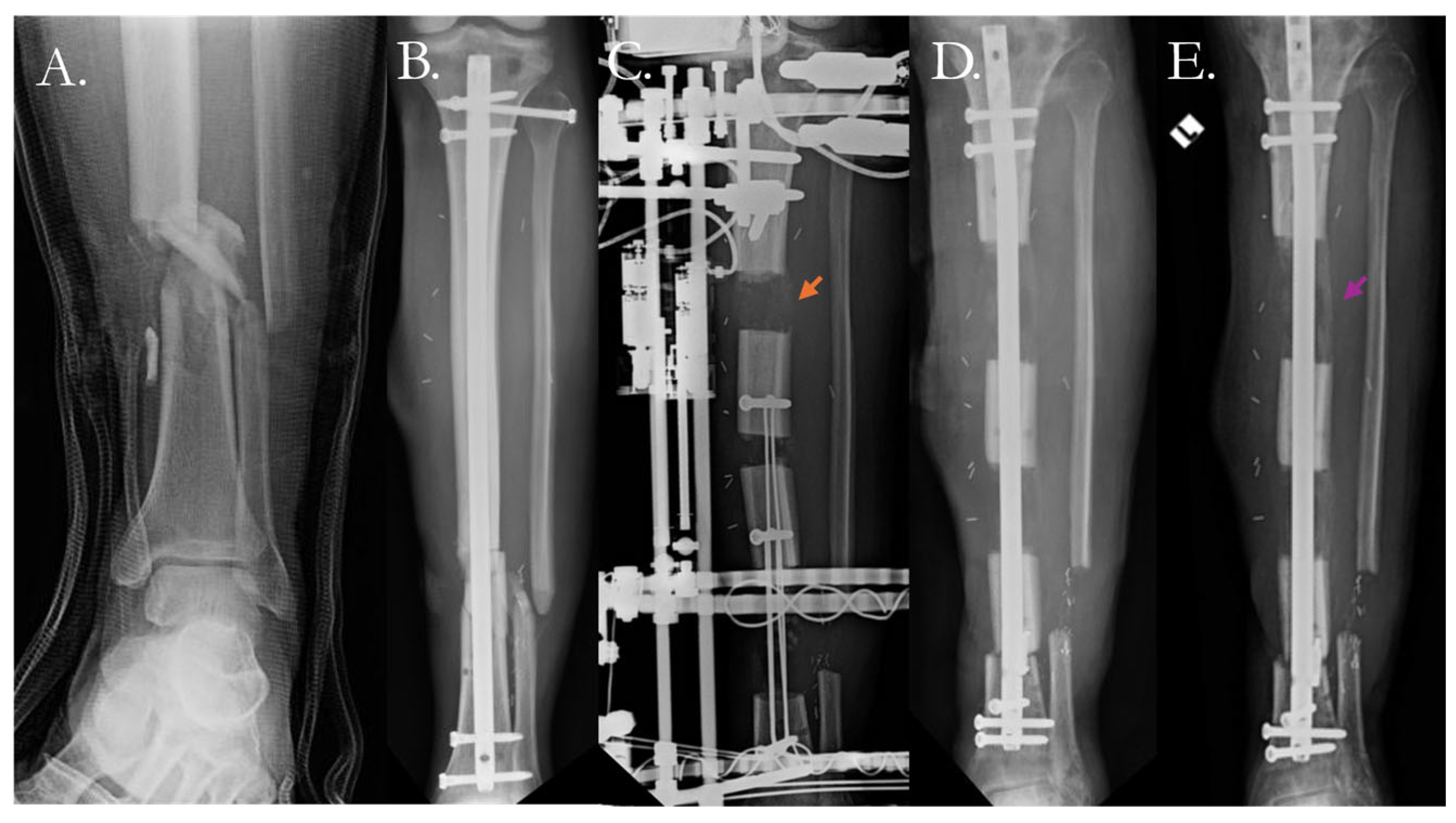 Pharmaceutics 17 01457 g006 Pharmaceutics 17 01457 g006