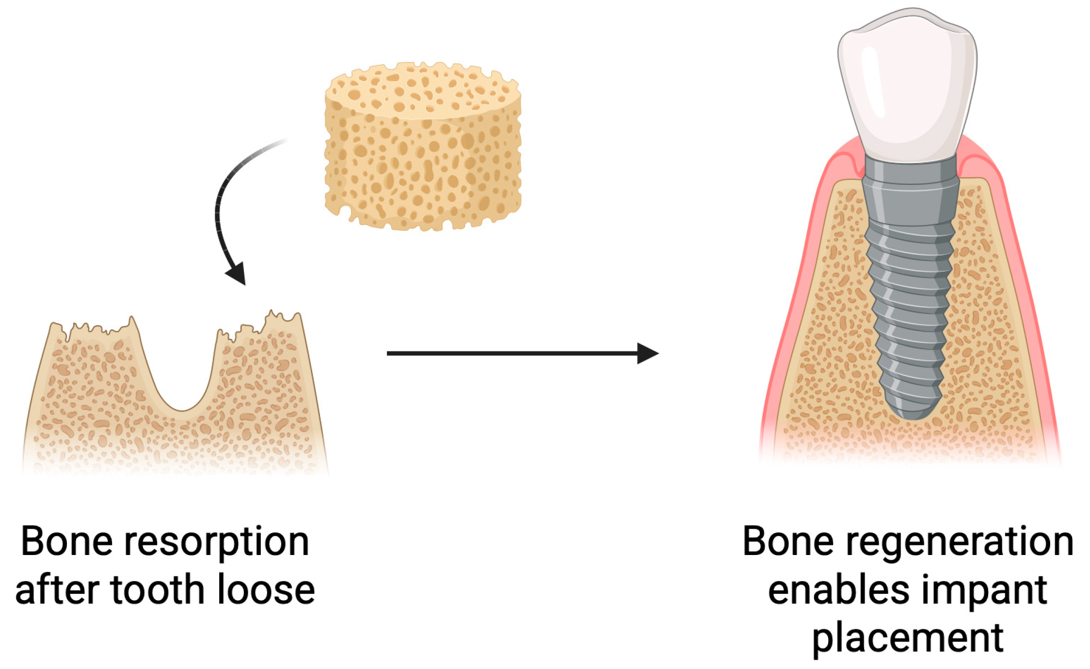 Pharmaceutics 17 01622 g008 Pharmaceutics 17 01622 g008