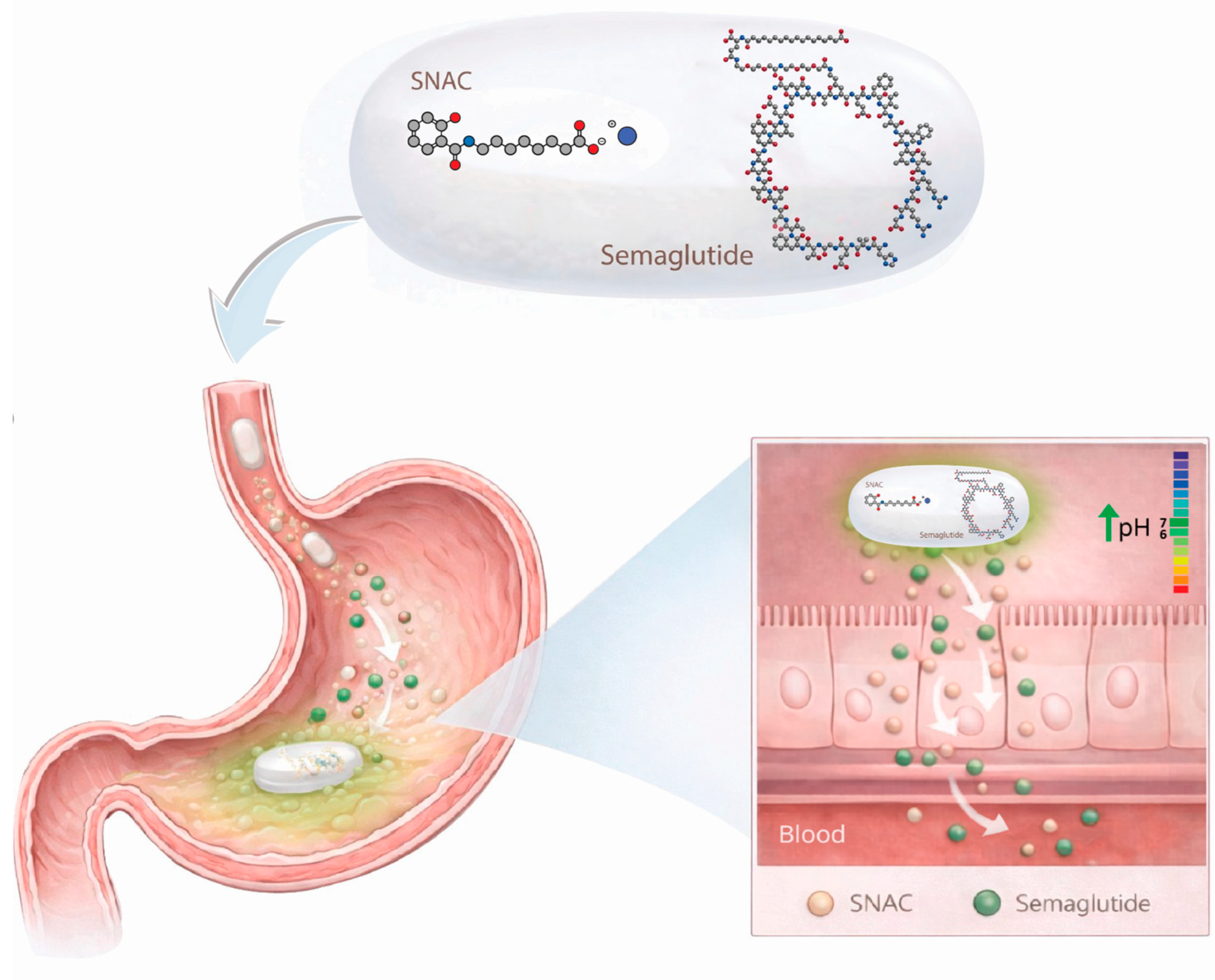semaglutide stomach rumbling Is Oral Semaglutide a Good Fit for Patients After Metabolic Bariatric  Surgery? A Biopharmaceutical Mechanistic Perspective