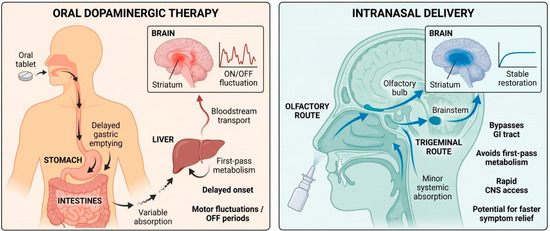 Nose-to-Brain Therapeutics in Parkinson's Disease: Clinical Trials, Mechanisms, and Therapeutic Potential