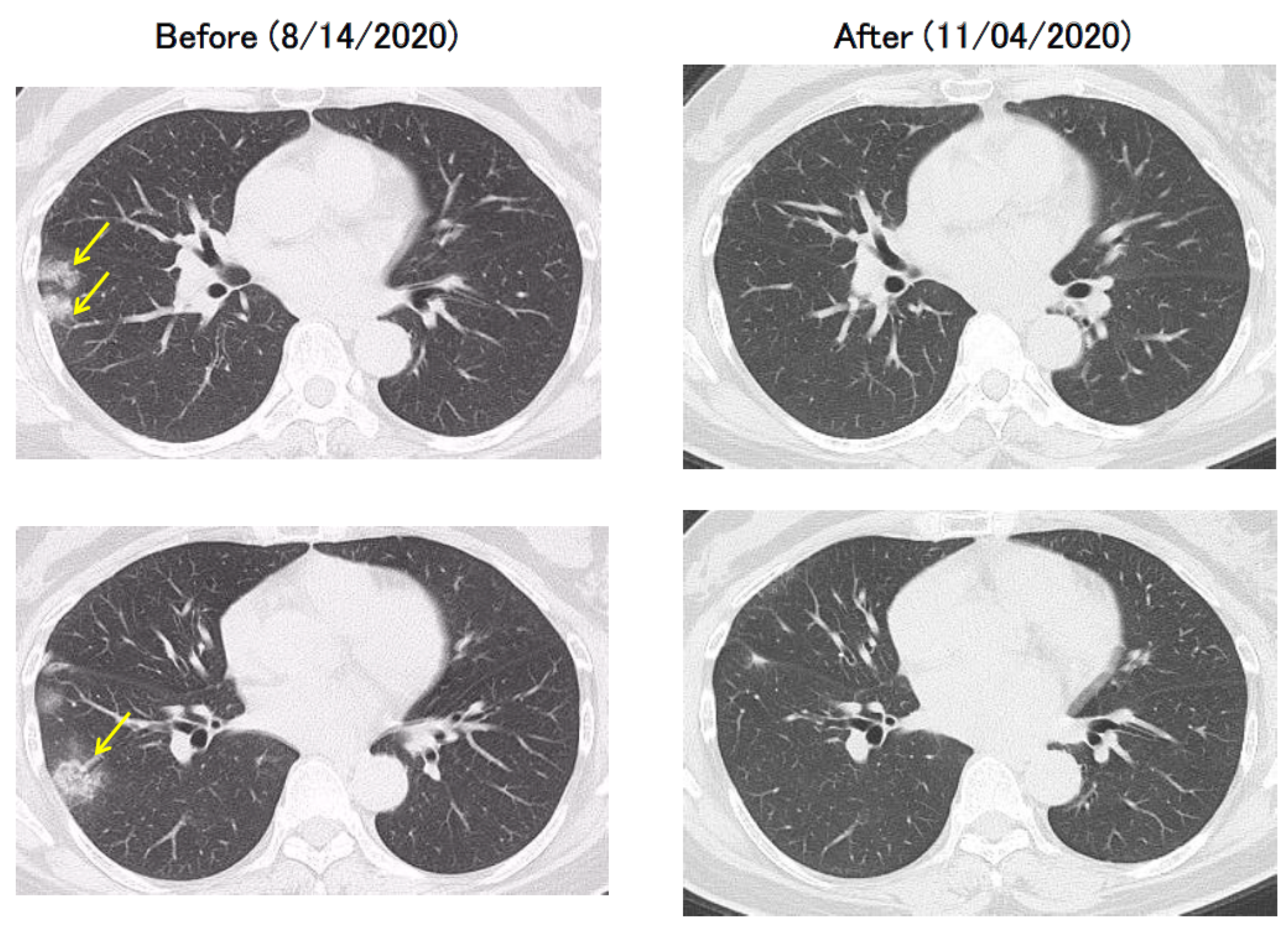 Pharmacoepidemiology 02 00017 g002 550