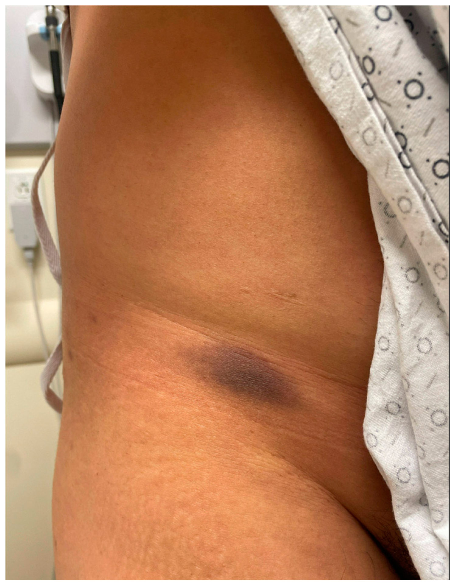 Pharmacoepidemiology 03 00028 g004