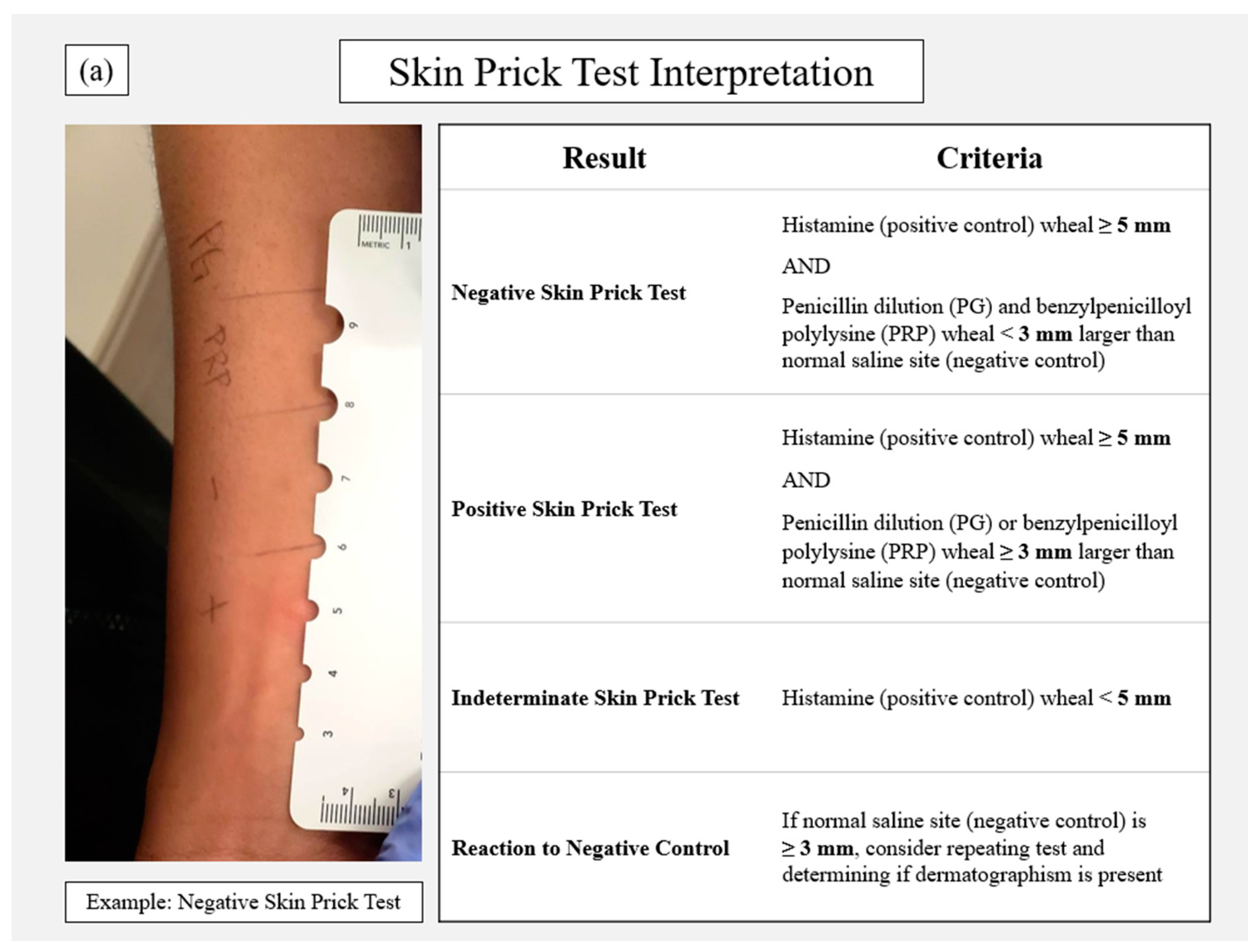 Pharmacy Free Full Text Penicillin Allergy Skin Testing In The 