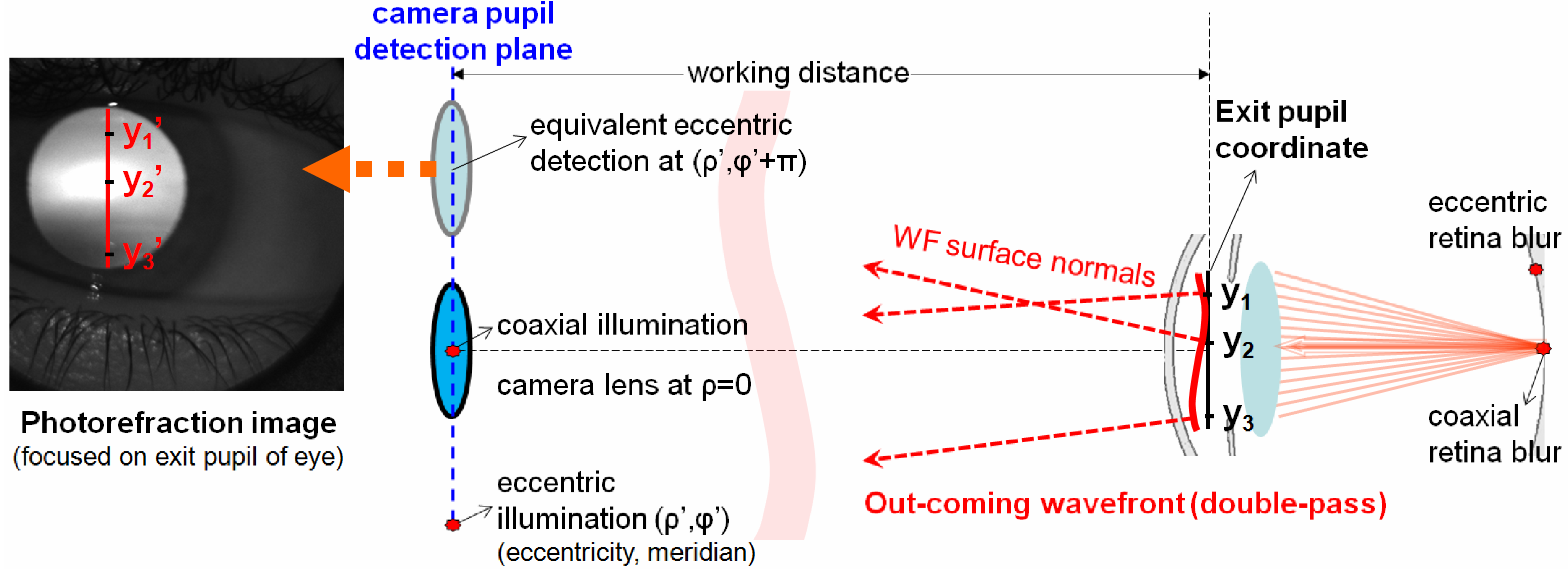 Photonics Free FullText Infrared Retinoscopy