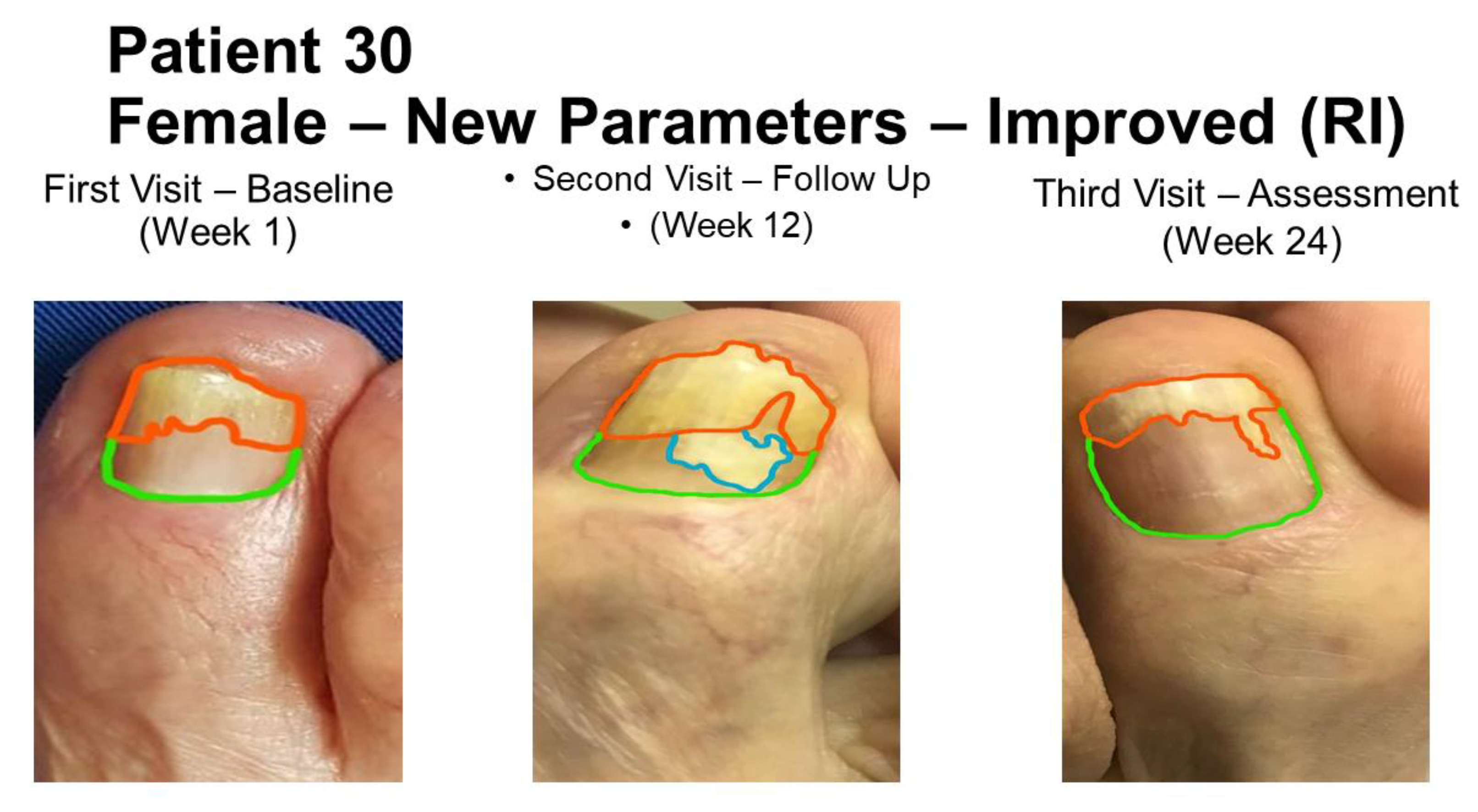 Nail problems | PPT