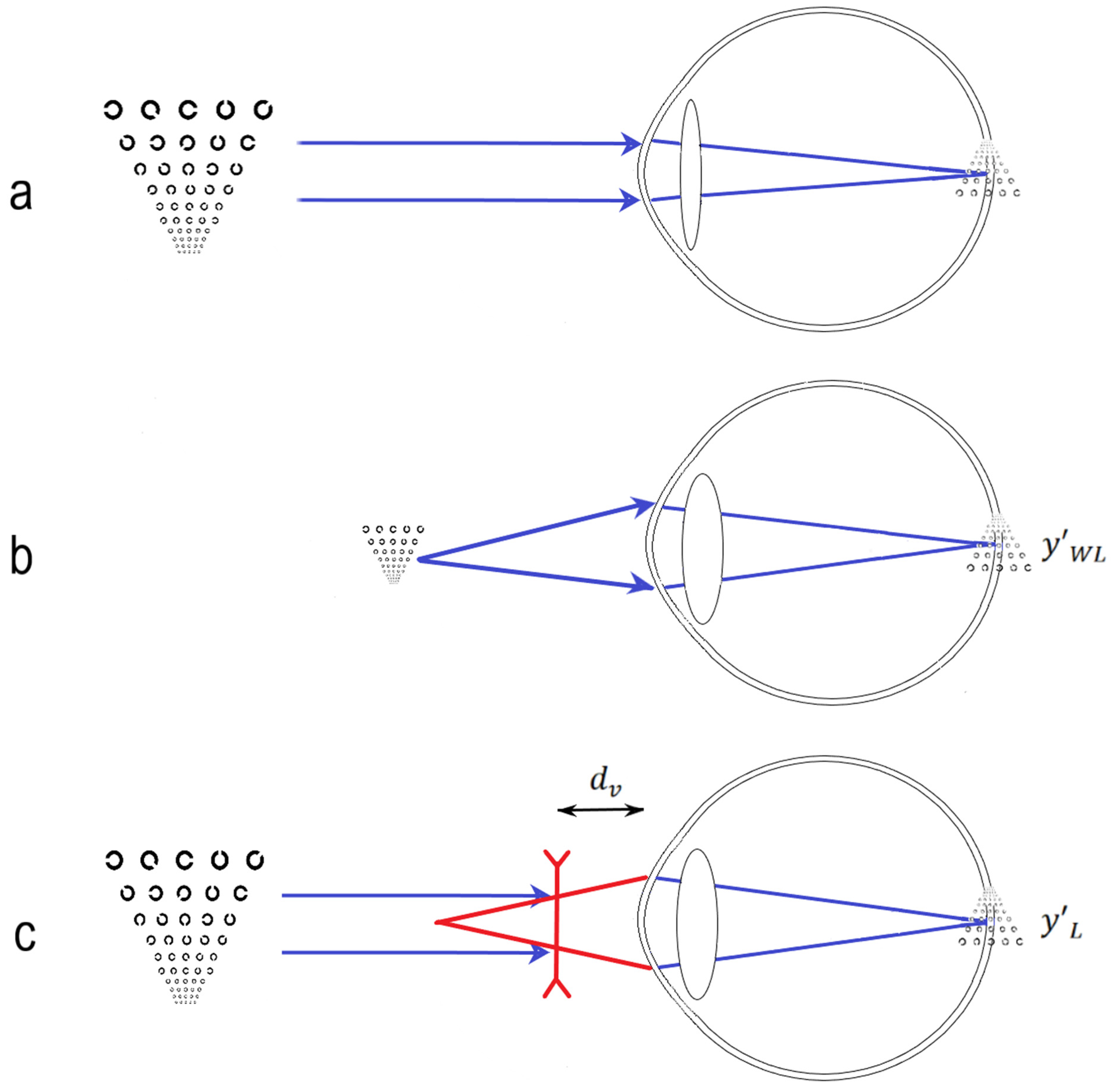 Photonics Free FullText Visual Acuity at Various Distances and