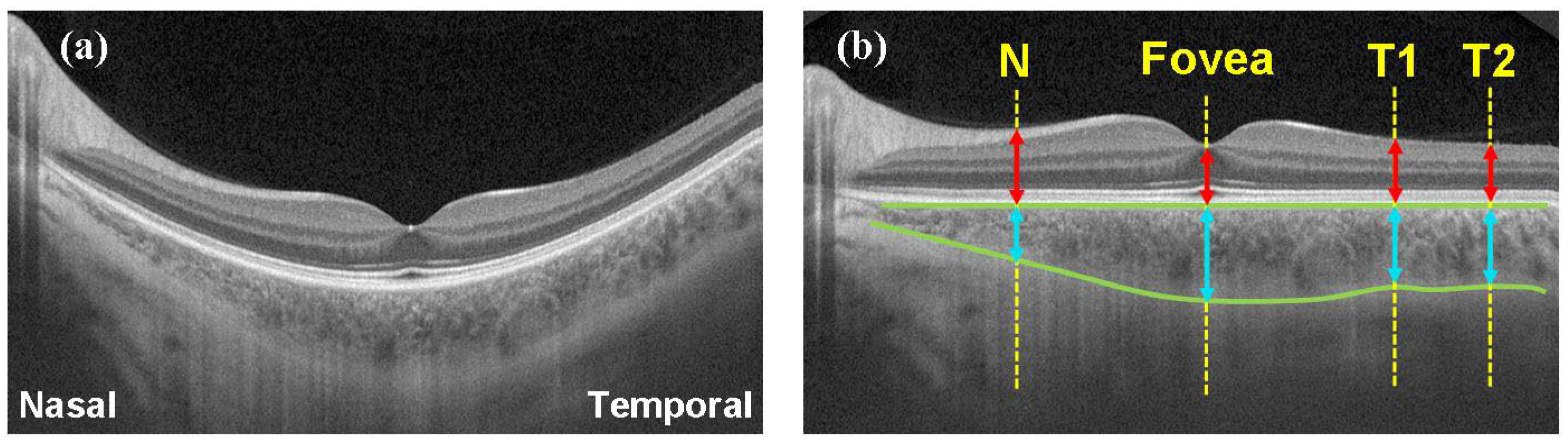 Photonics 09 00328 g002