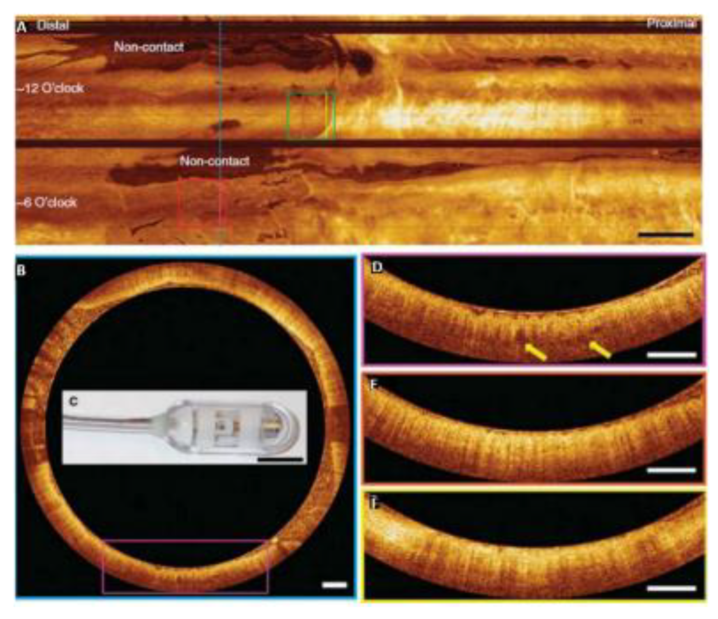 Photonics 10 00051 g004