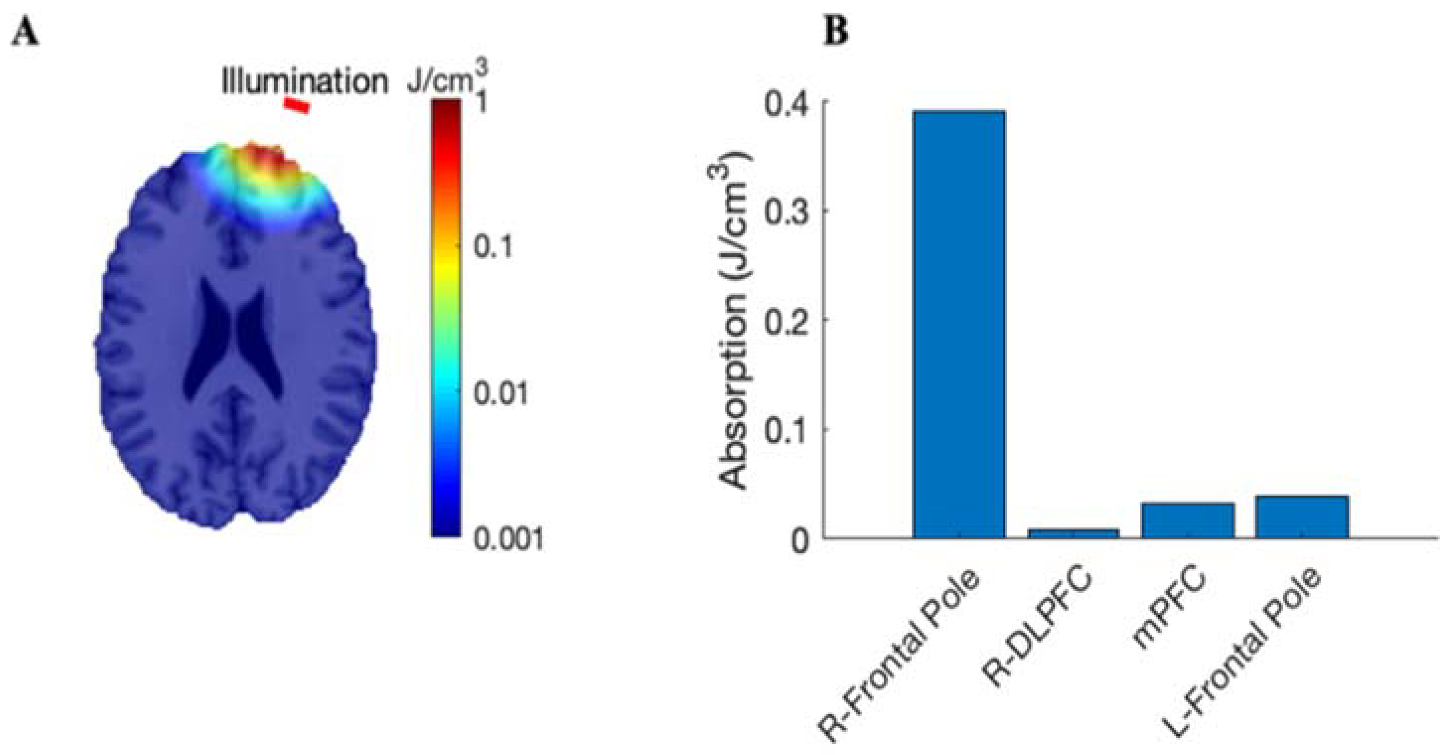 Photonics 10 00090 g001 Photonics 10 00090 g001