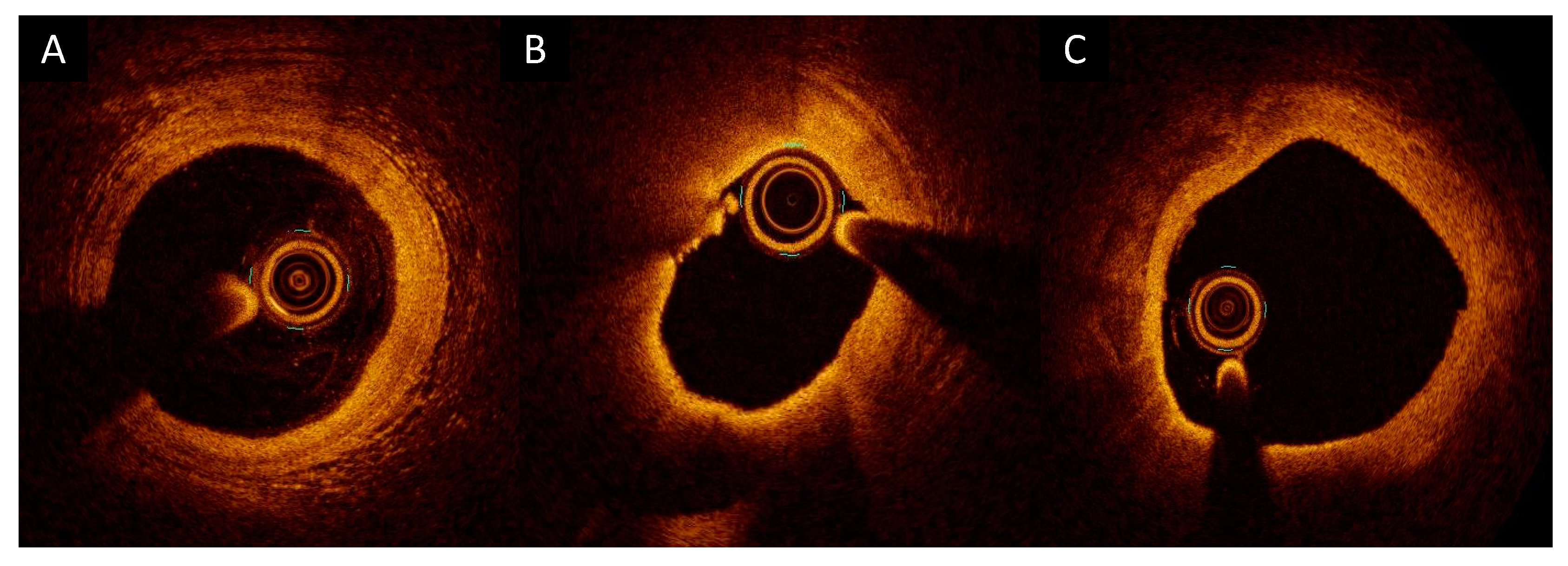 Photonics 10 00158 g001
