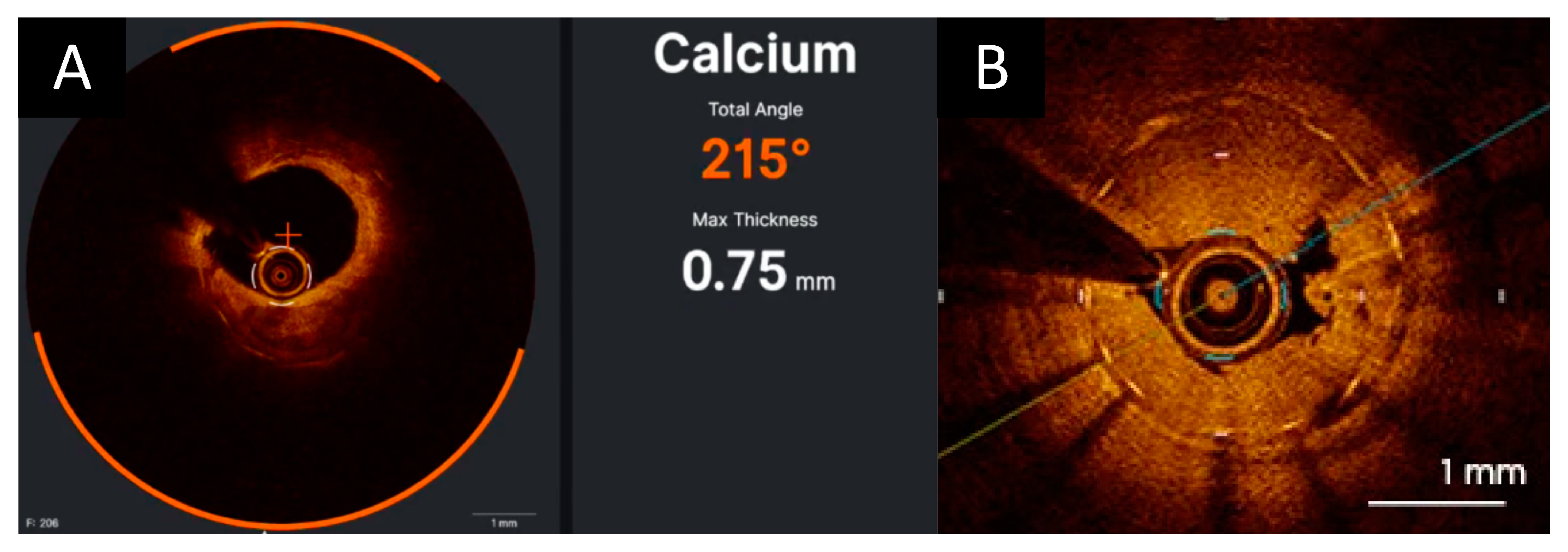 Photonics 10 00158 g004