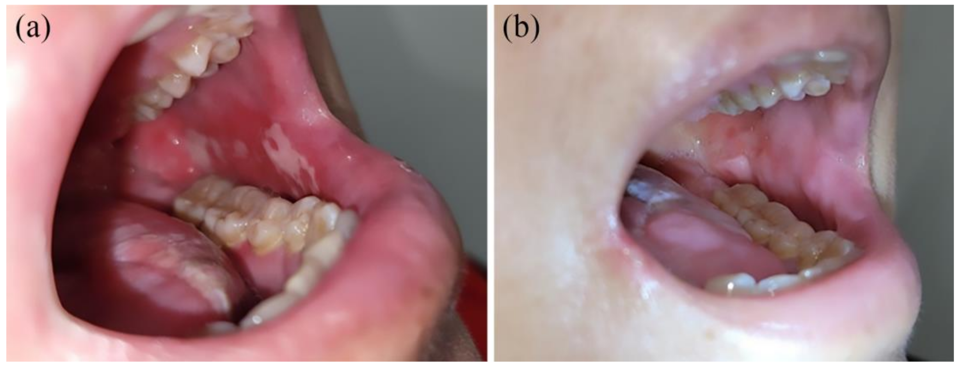 Photonics 10 00241 g003 Photonics 10 00241 g003