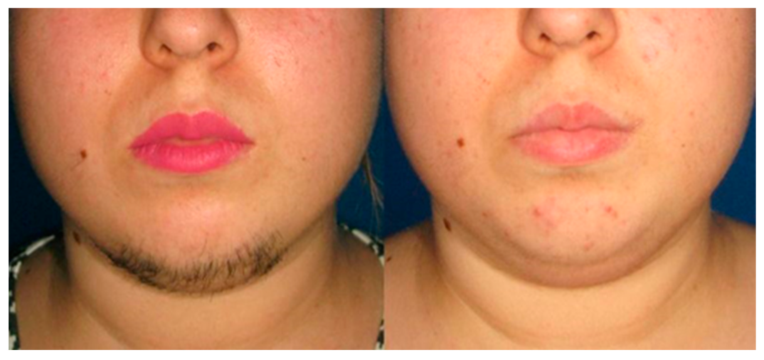 Photonics 10 00572 g004