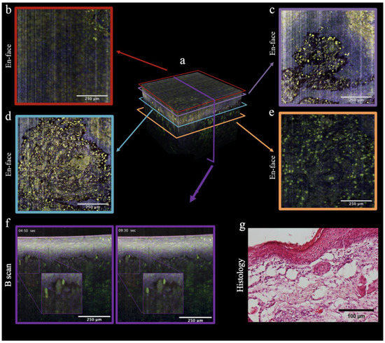 Dynamic Microscopic Optical Coherence Tomography as a New Diagnostic ...
