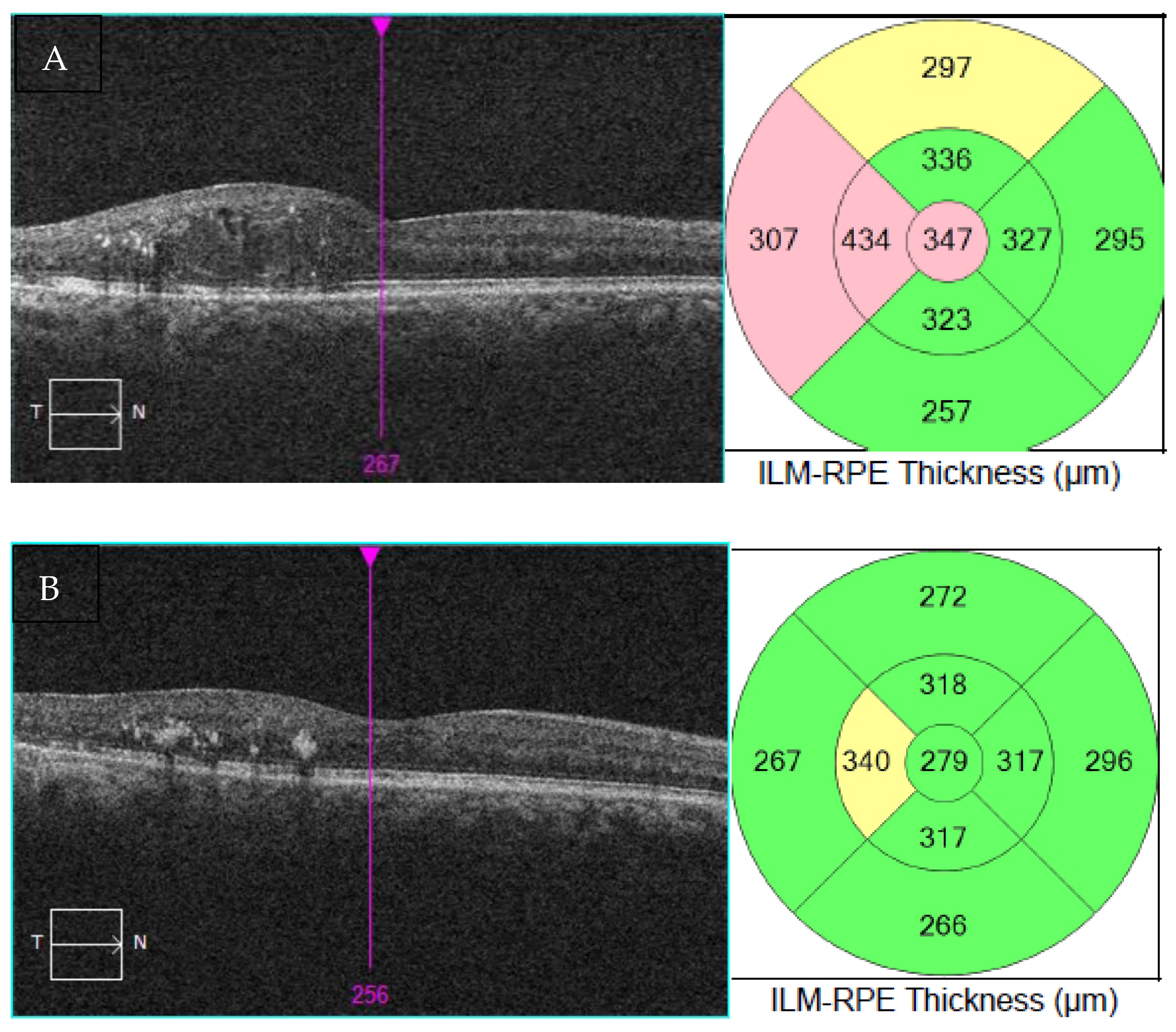 Photonics 10 01165 g001