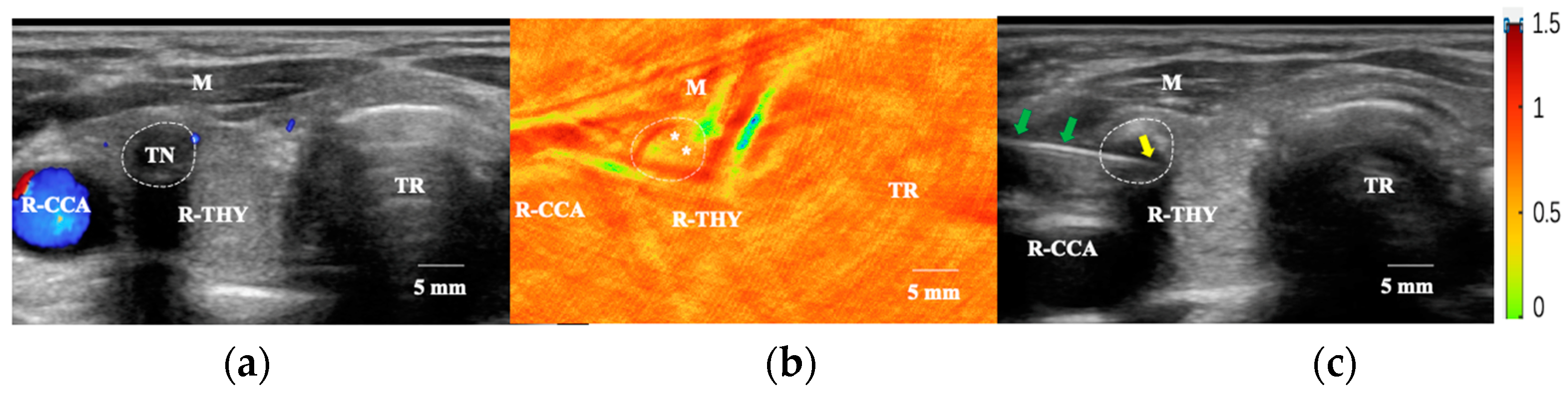 Photonics 10 01190 g004 Photonics 10 01190 g004