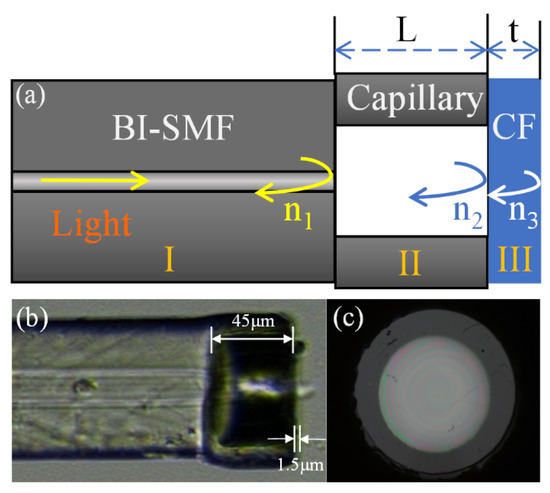 ディストーション Metabolic Dysfunction–Associated Steatotic Liver Disease