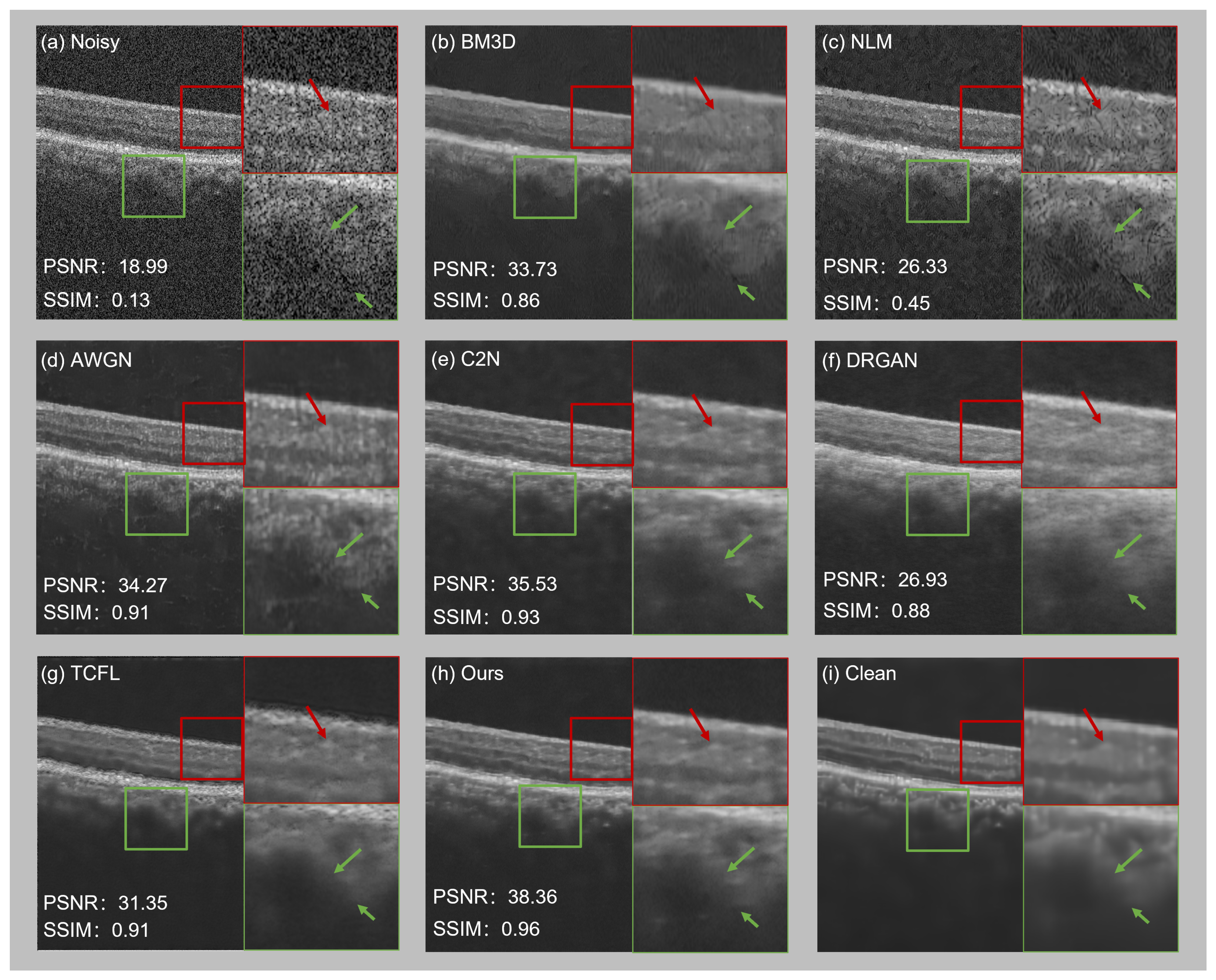 Photonics 11 00569 g005