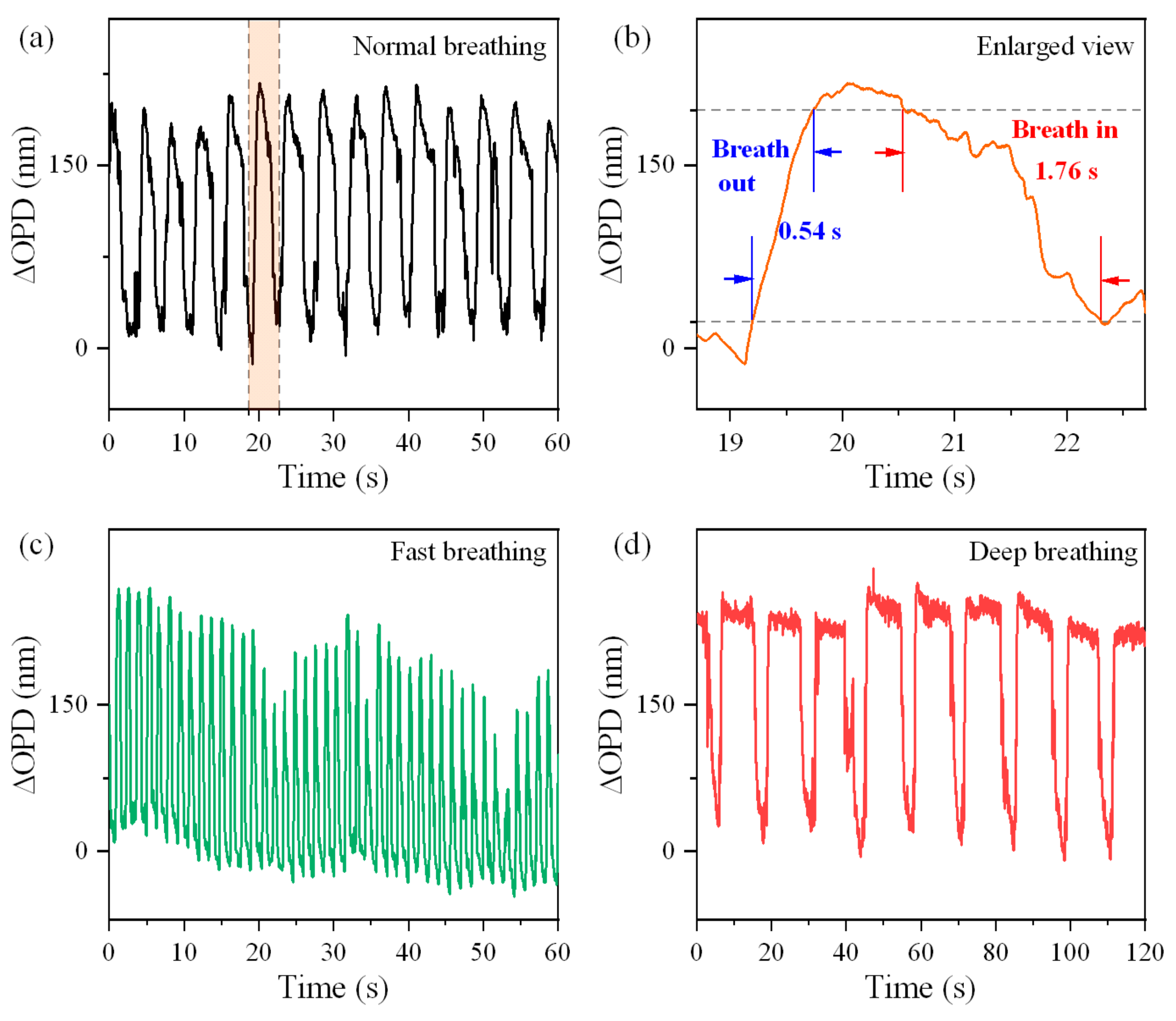 Photonics 12 00045 g011