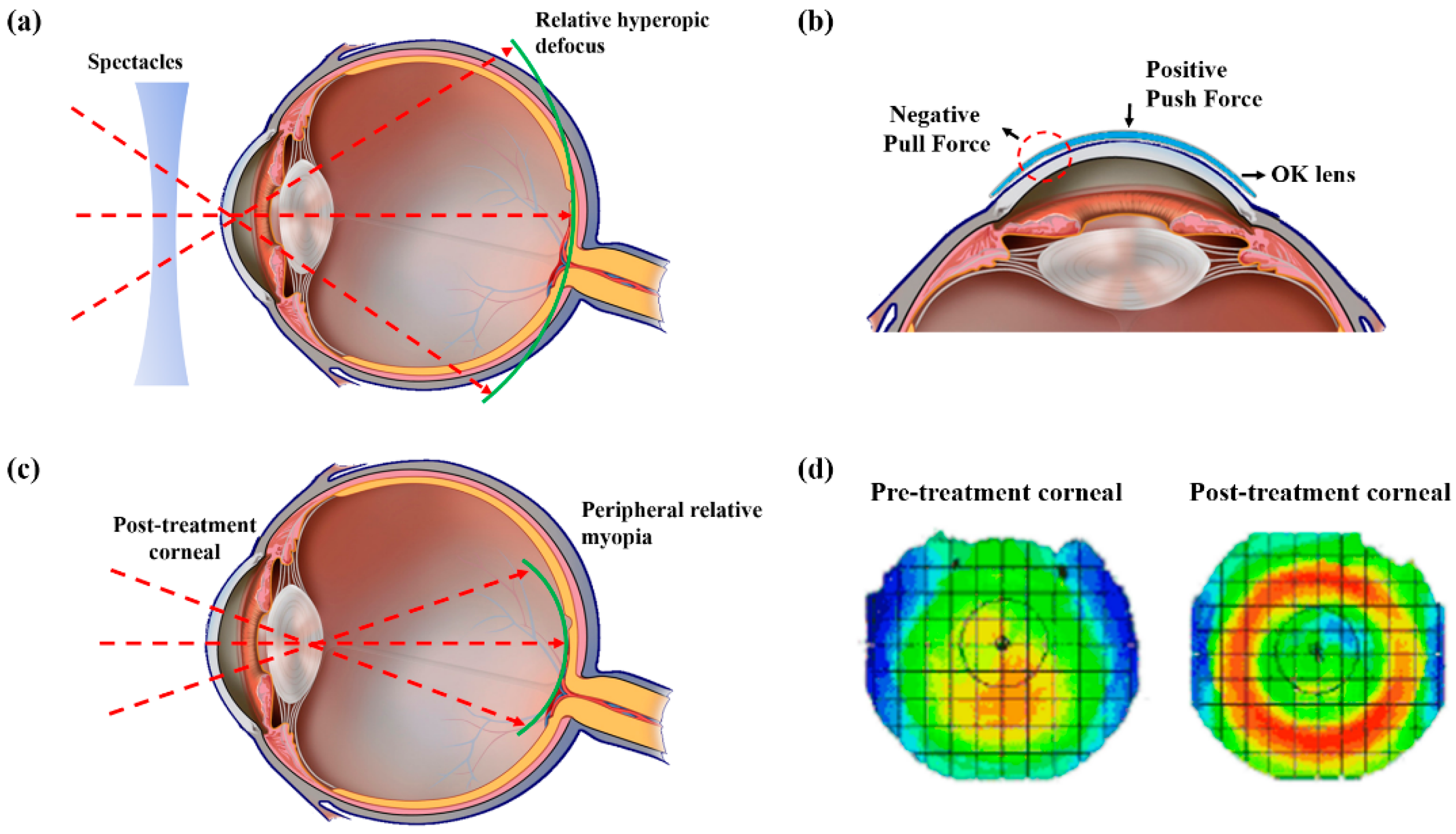 Photonics 12 00087 g001