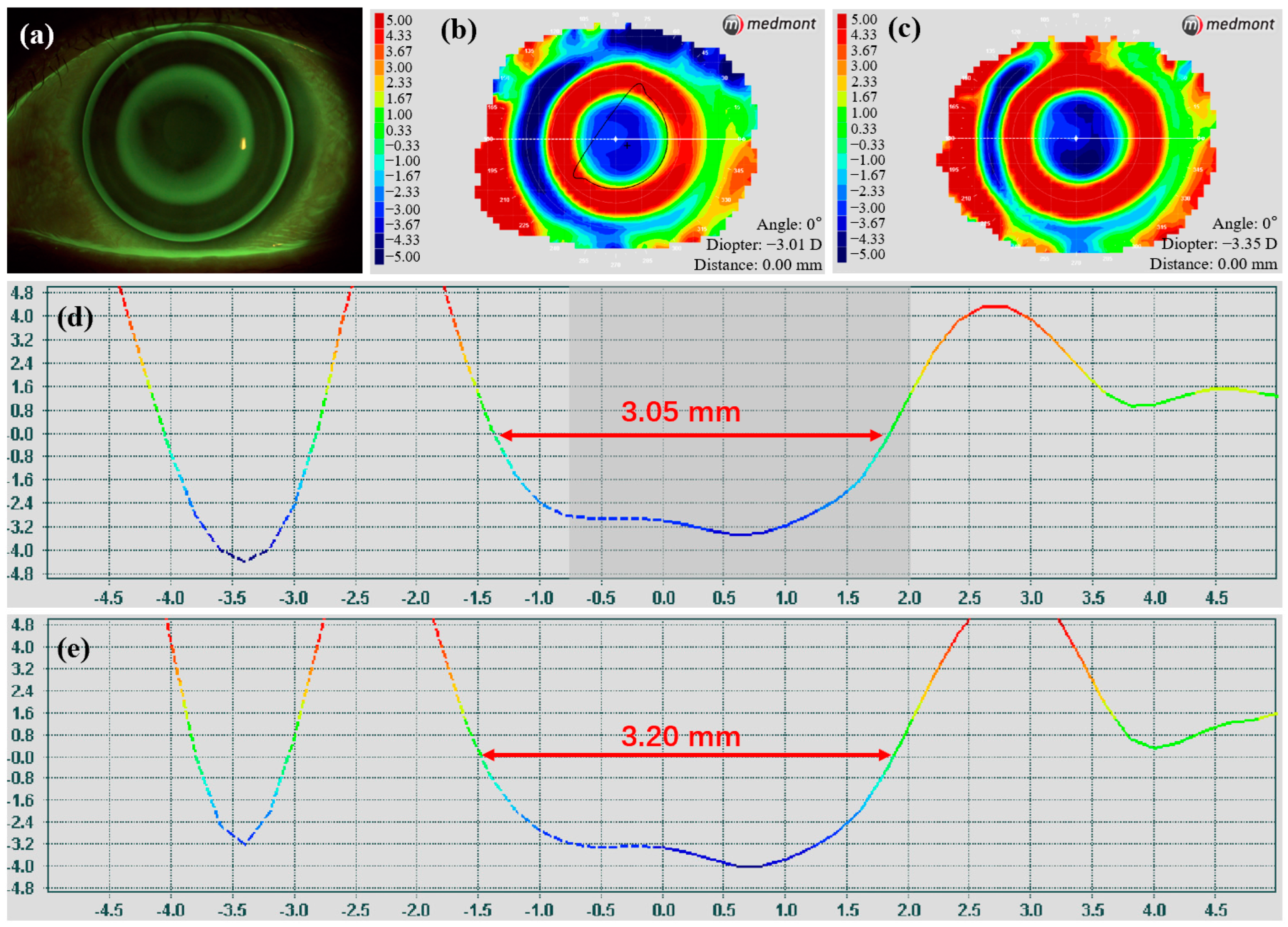 Photonics 12 00087 g010