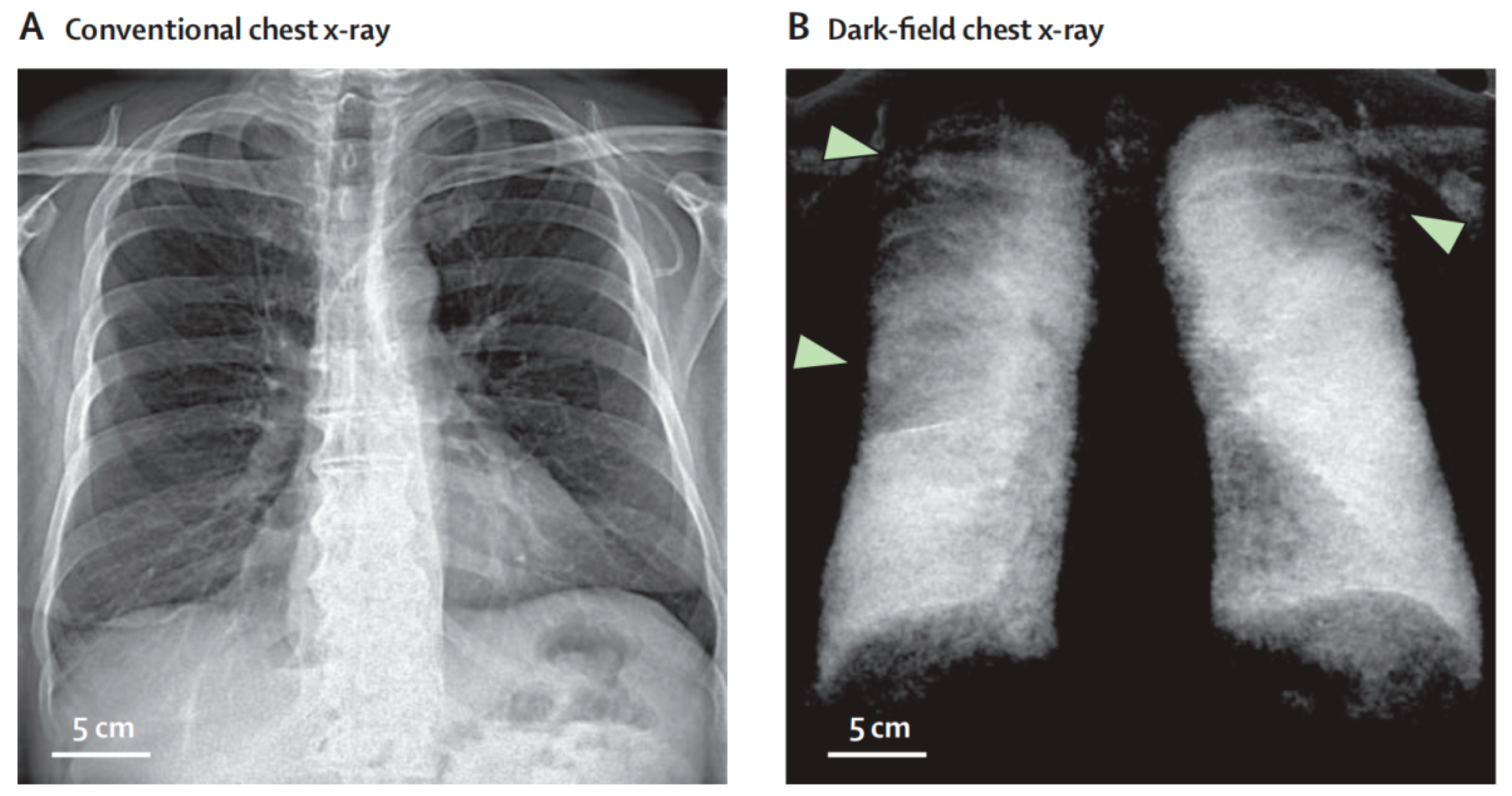 Photonics 12 00222 g018