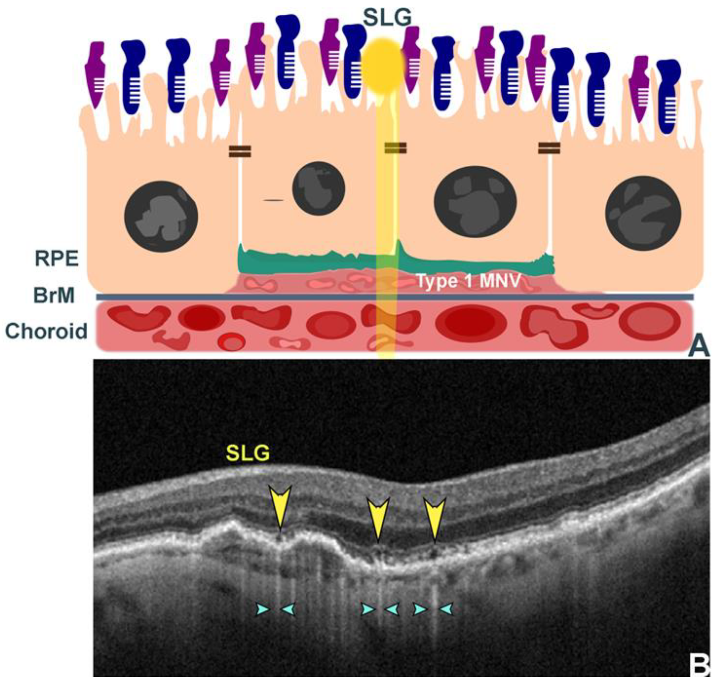 Photonics 12 00237 g006