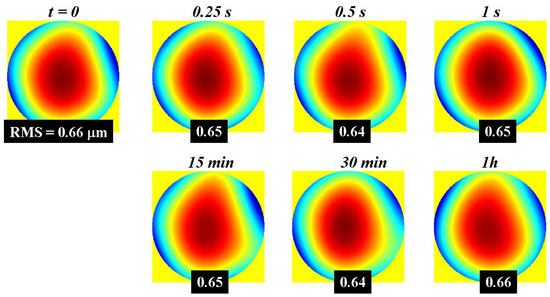 Identification of Spatial Specific Lipid Metabolic