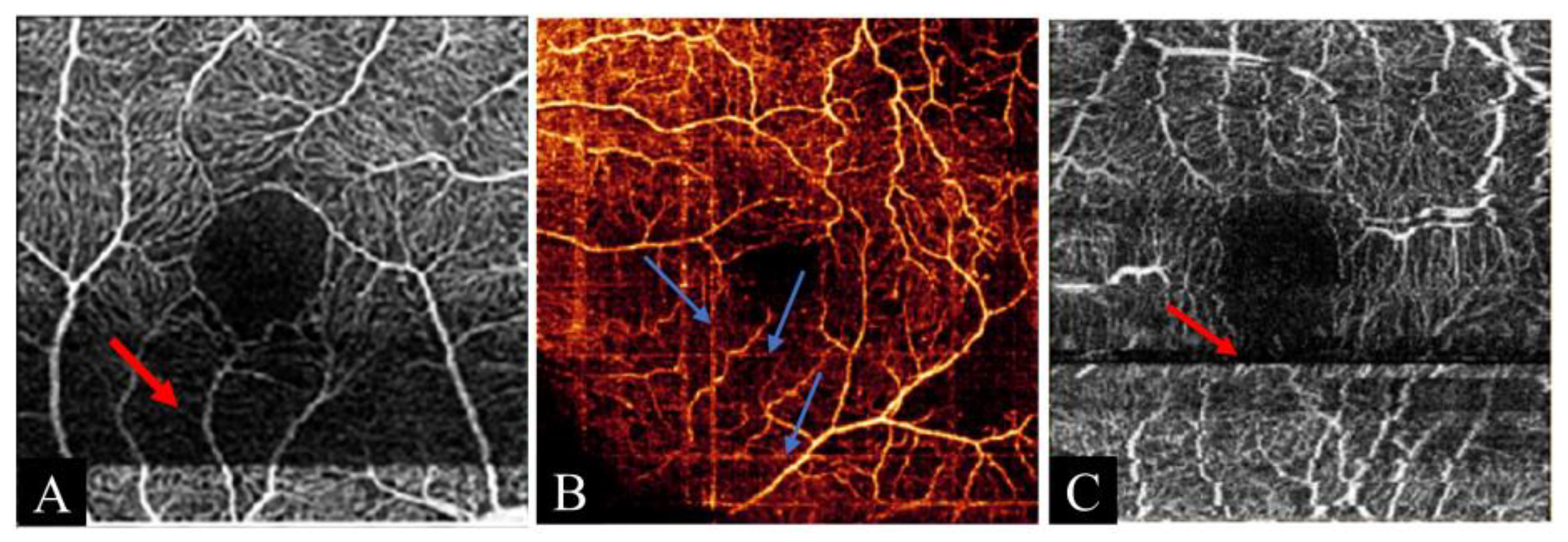 Photonics 12 00536 g009