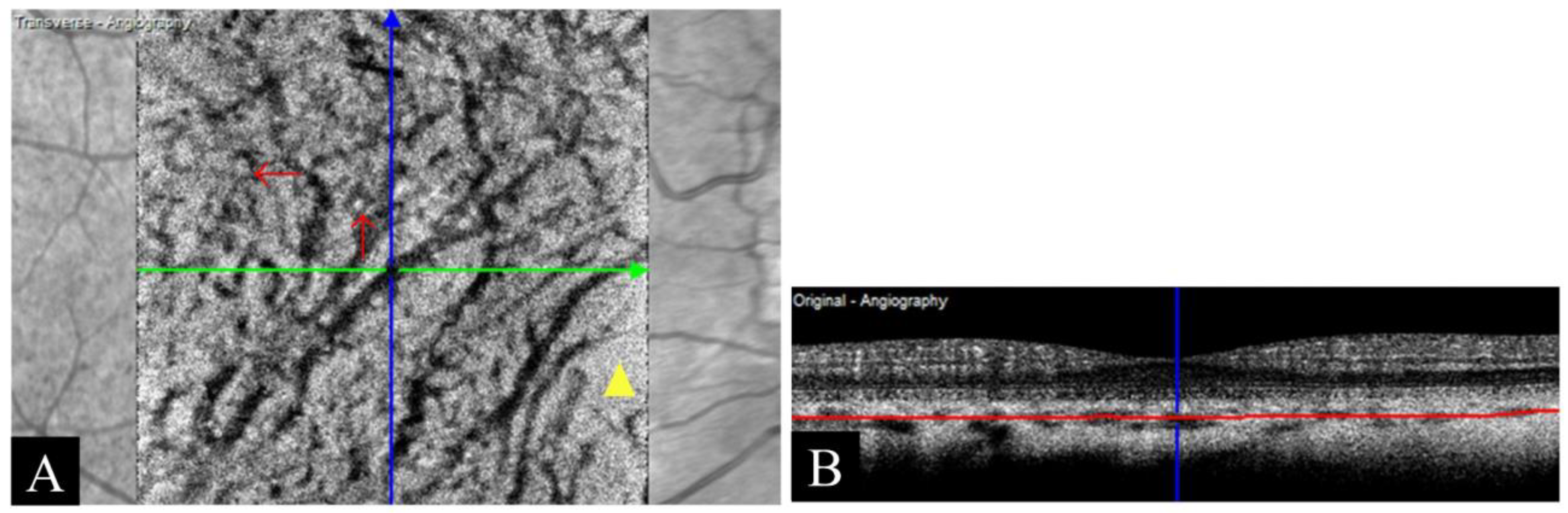 Photonics 12 00536 g010