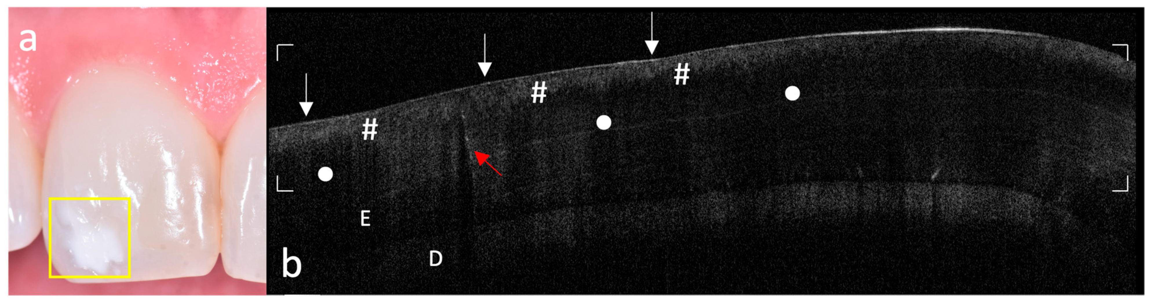 Photonics 12 00799 g004