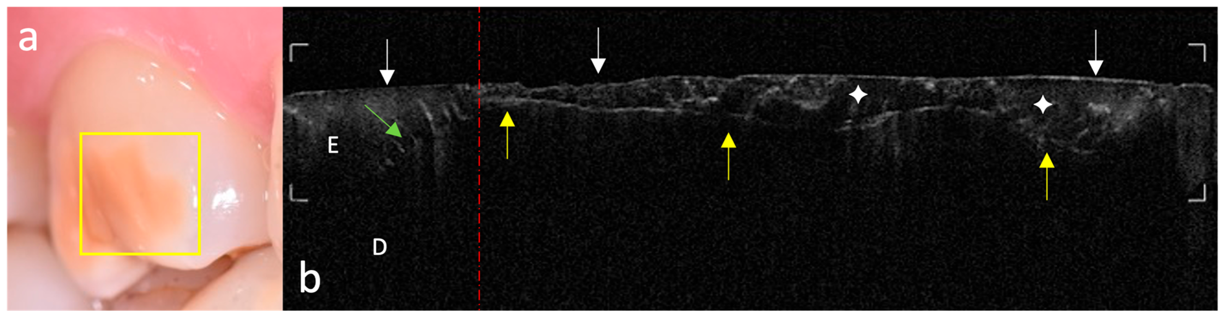 Photonics 12 00799 g005