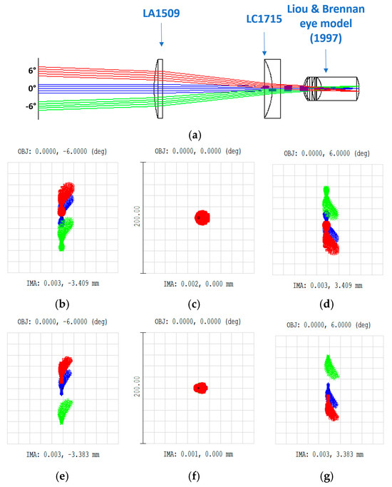 3D Printed Galilean Telescope for Low-Vision Patients