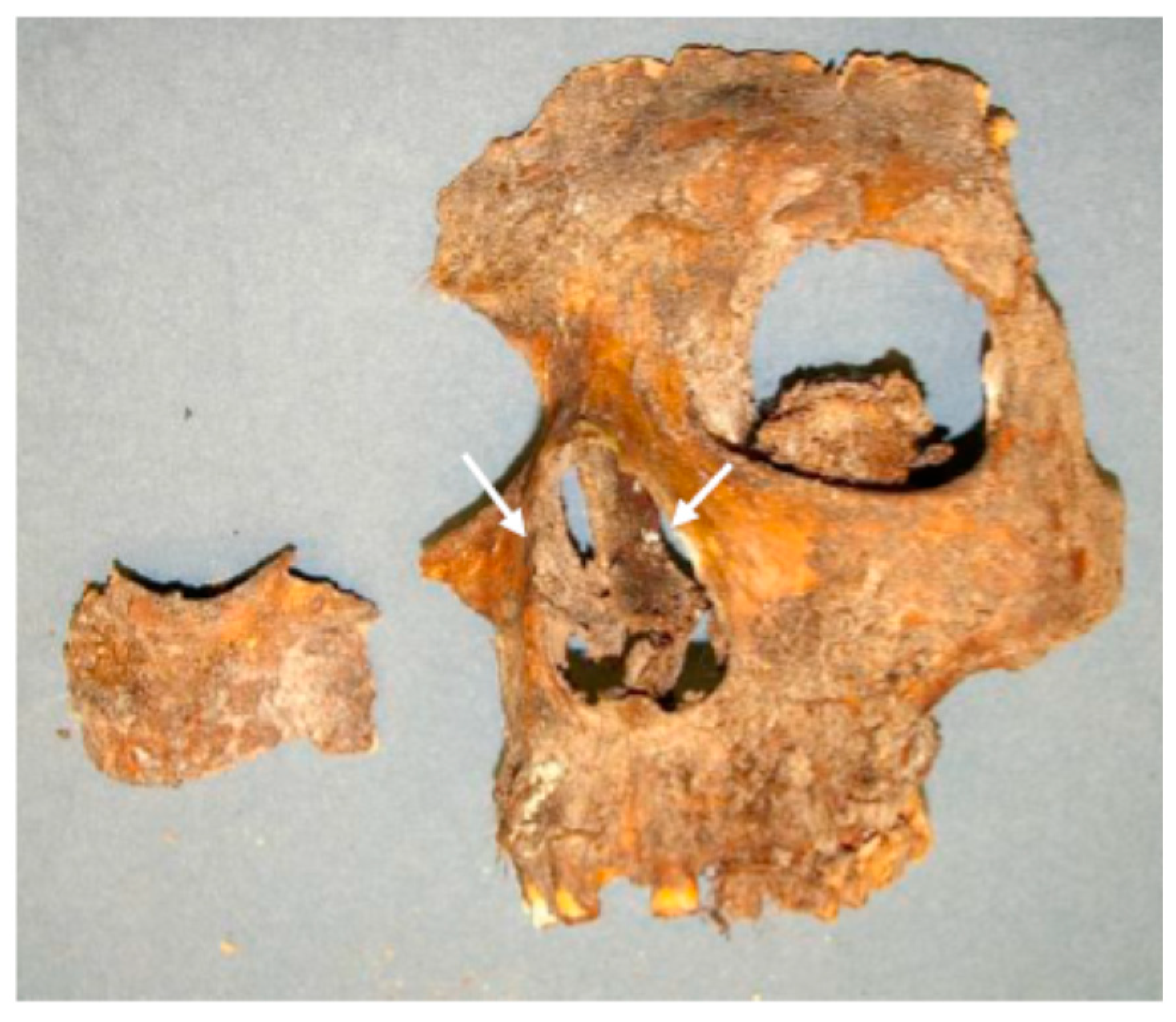 Physics 04 00033 g008