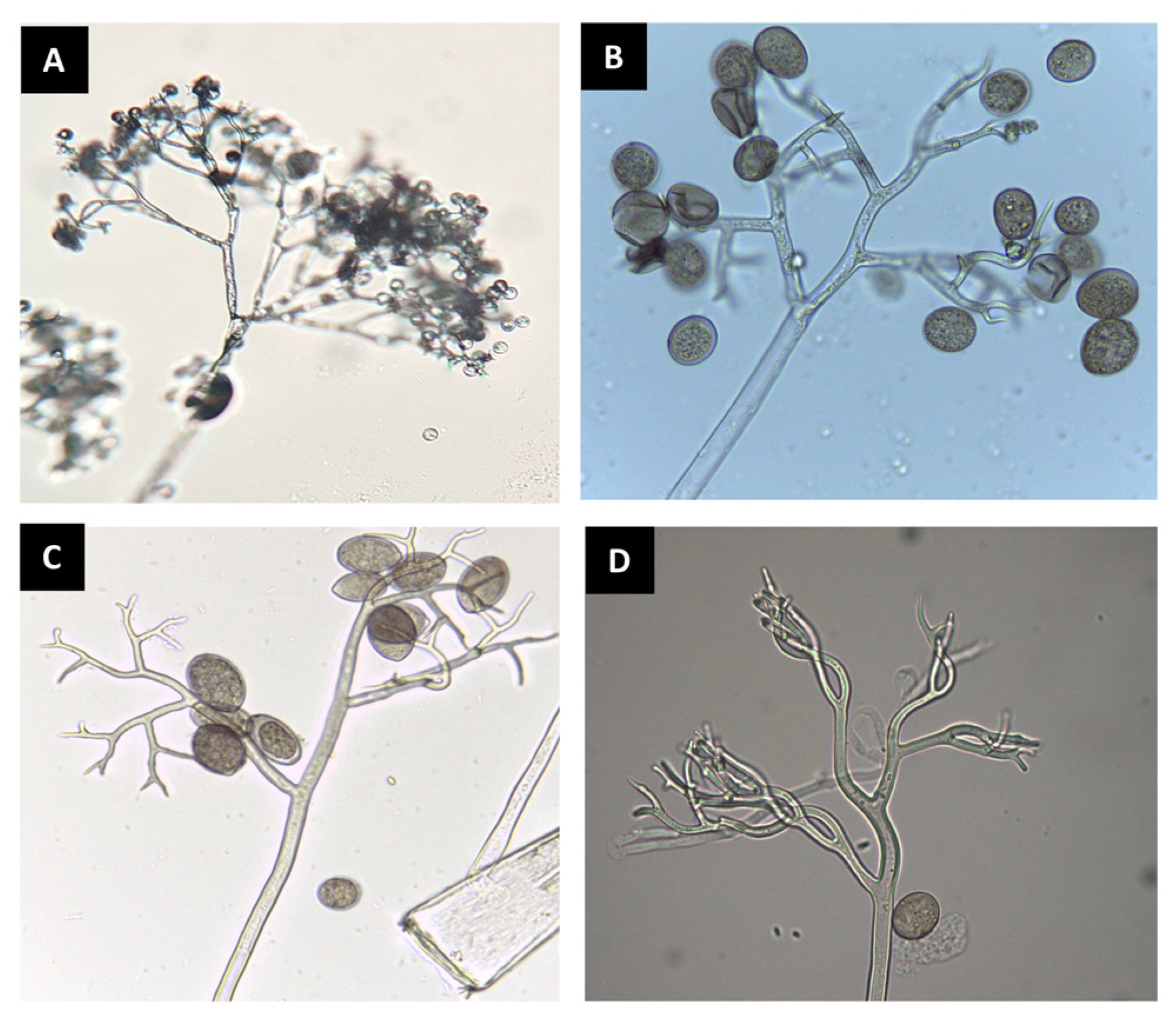 Plants Free Full Text Fantastic Downy Mildew Pathogens And How To Find Them Advances In Detection And Diagnostics Html