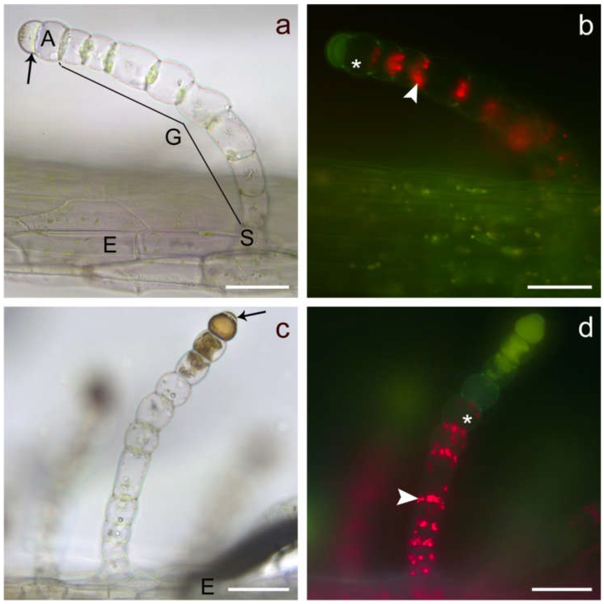 Plants Free FullText Ultrastructural Alterations in Cells of