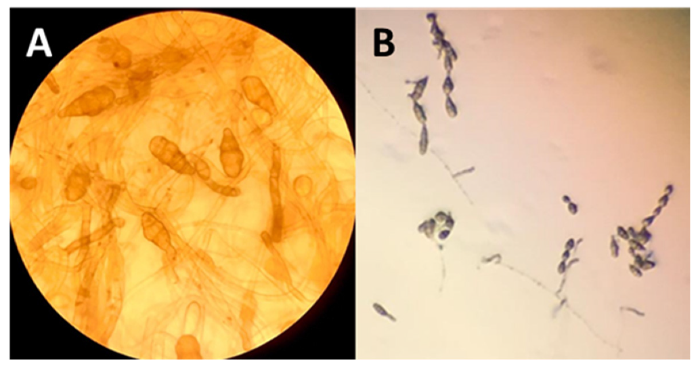 Plants 11 00924 g006 Plants 11 00924 g006