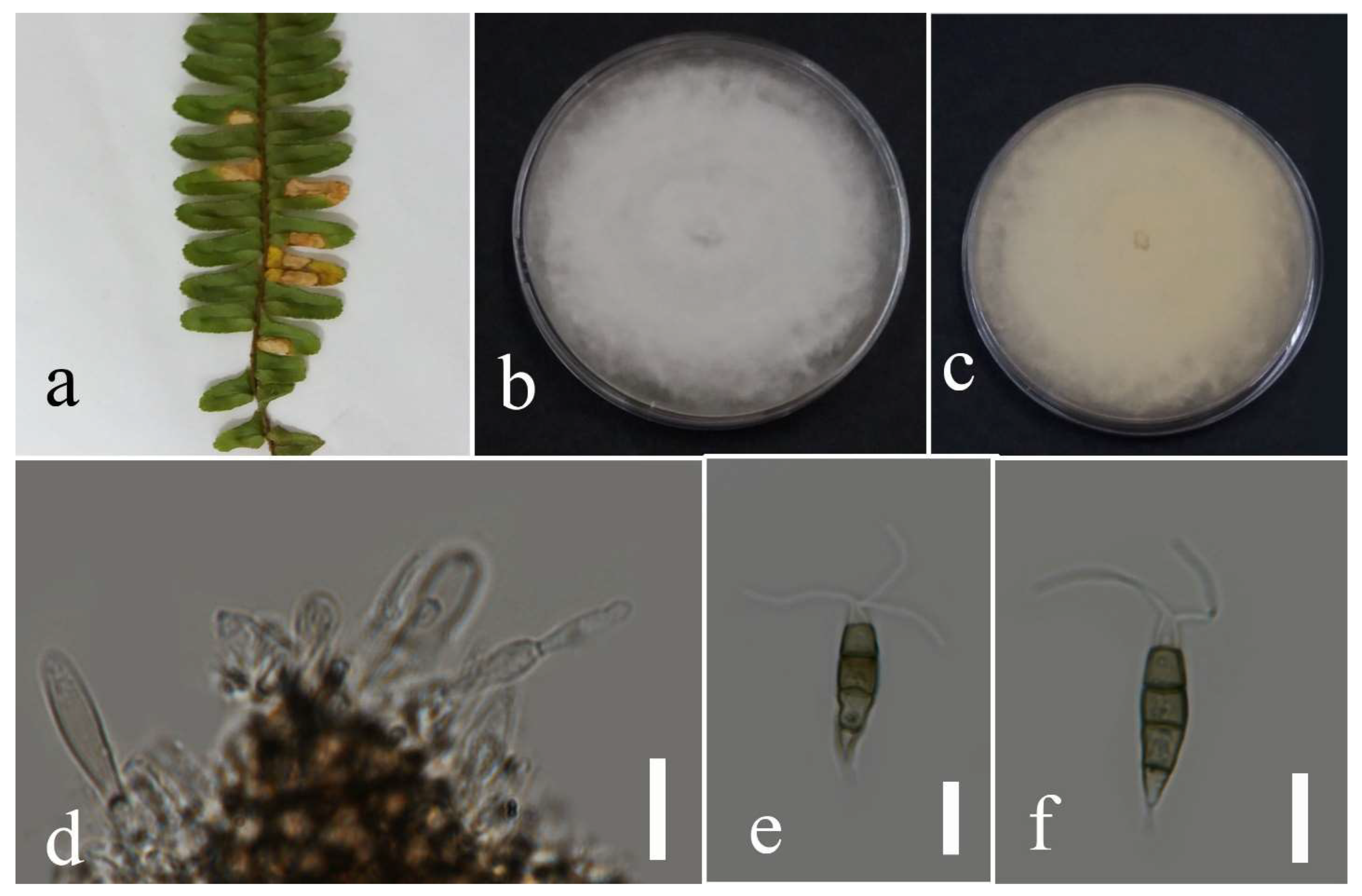 Plants 12 00683 g011