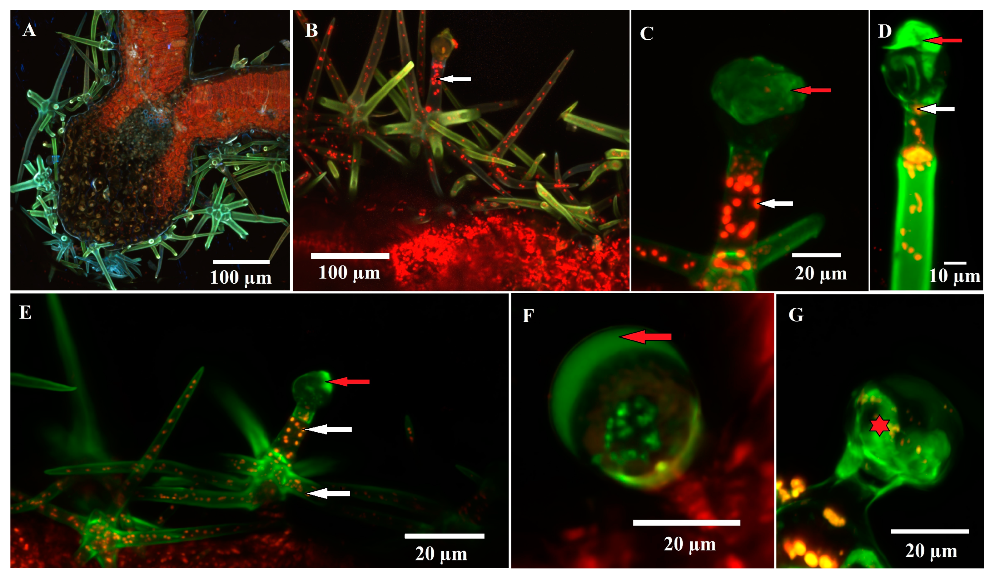 Trichome on leaf of Arabidopsis thaliana  Scanning electron microscopy,  Microscopy, Electron microscope