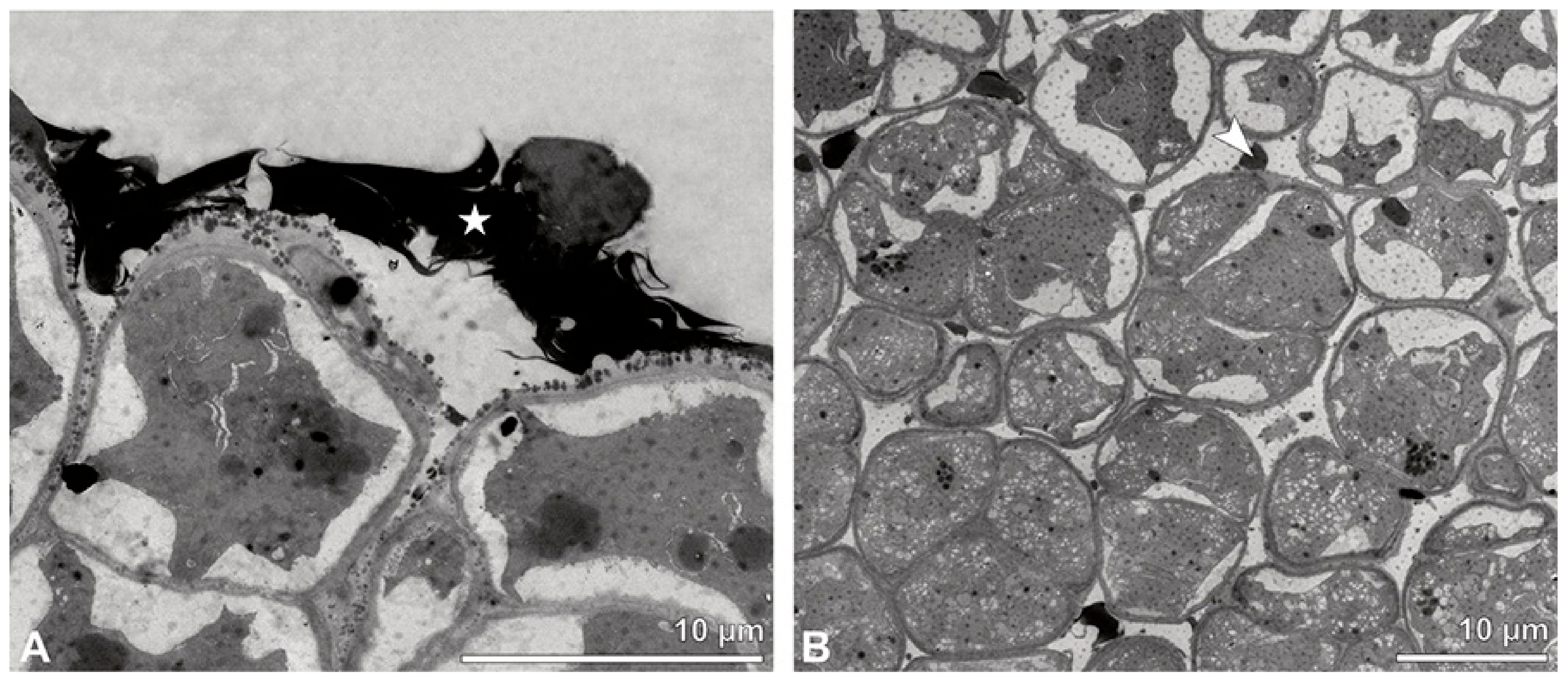 Plants 13 01114 g018