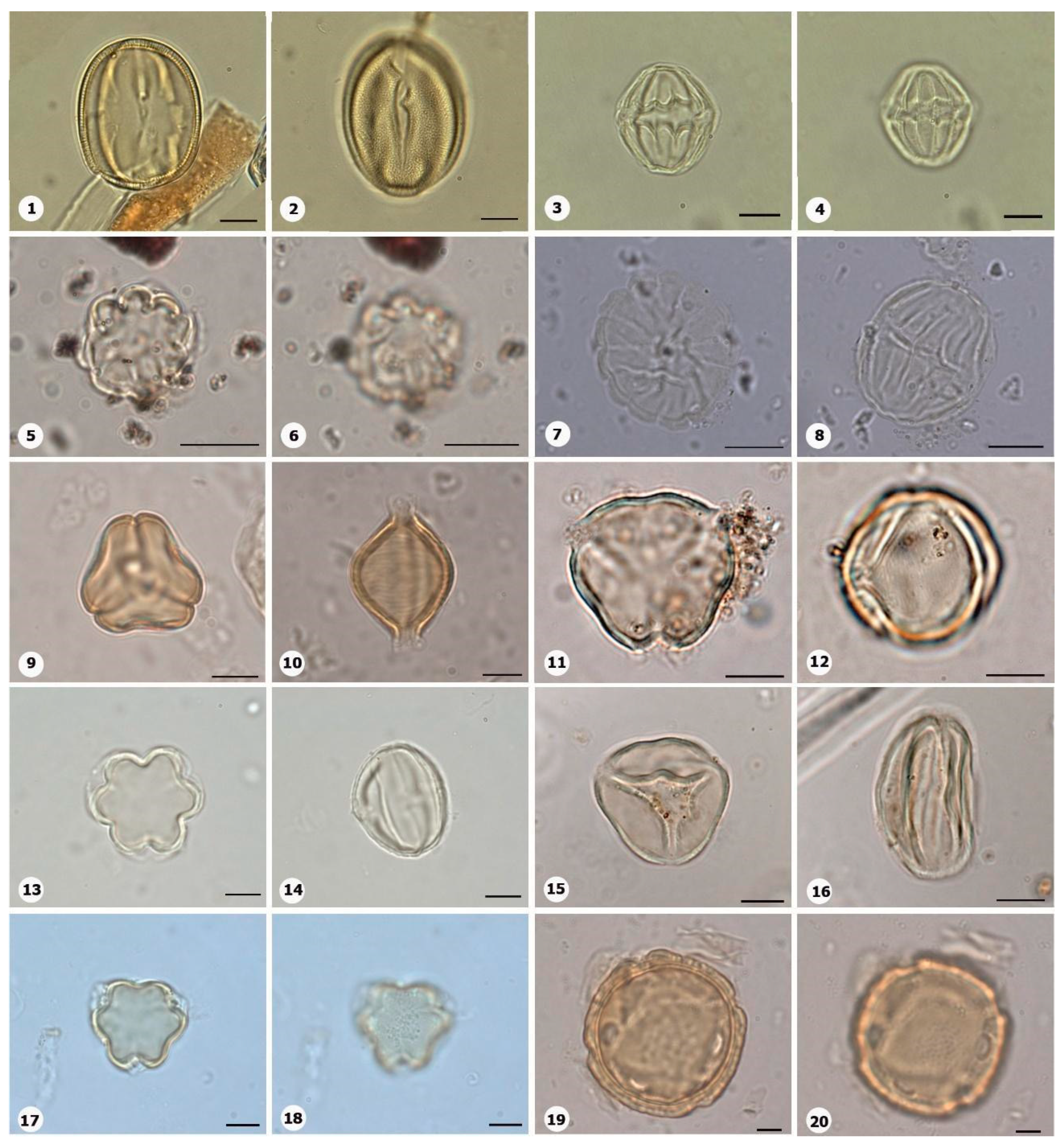 Plants 14 01319 g017