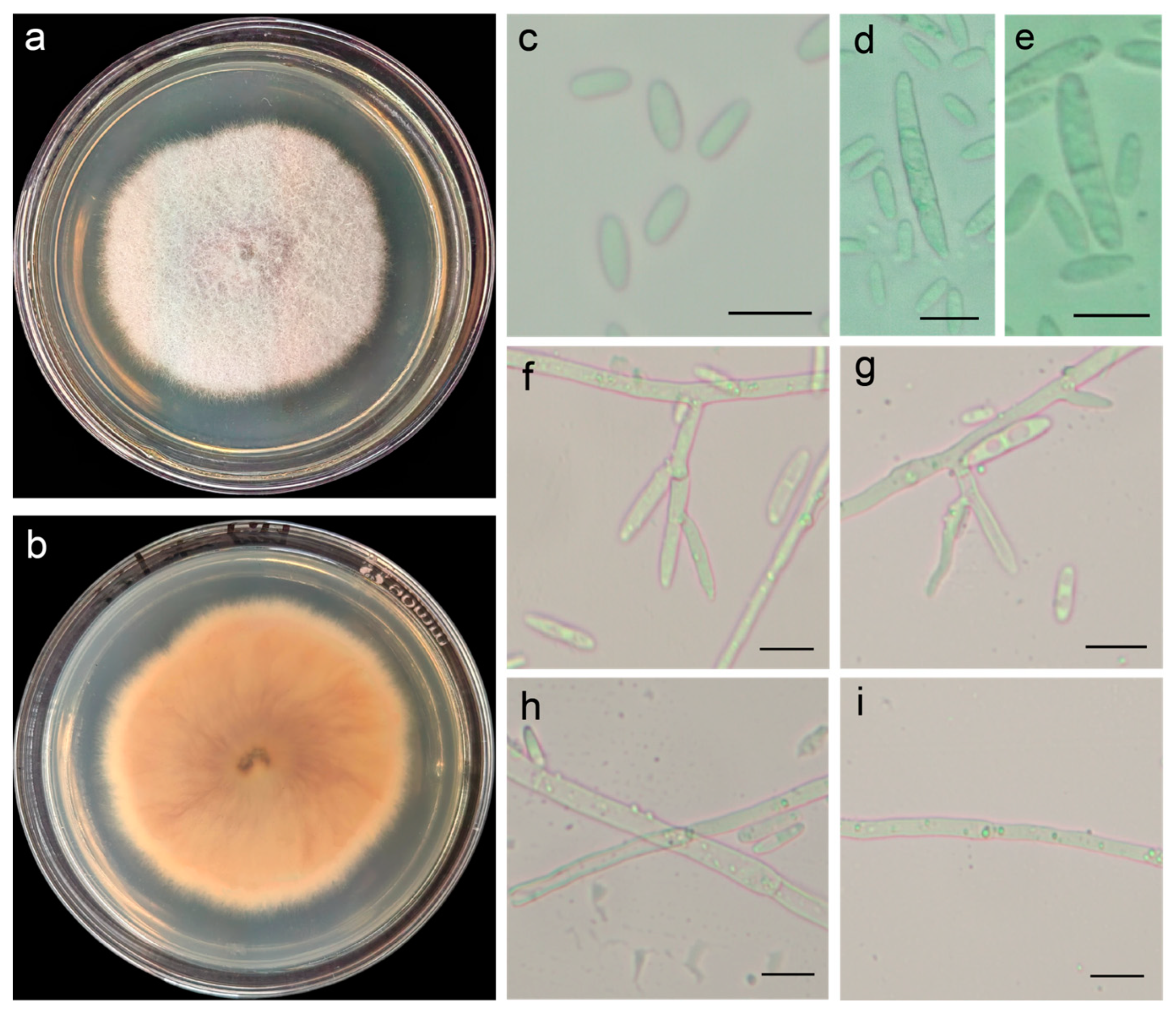 First Report of Fusarium proliferatum Infection in Pods of