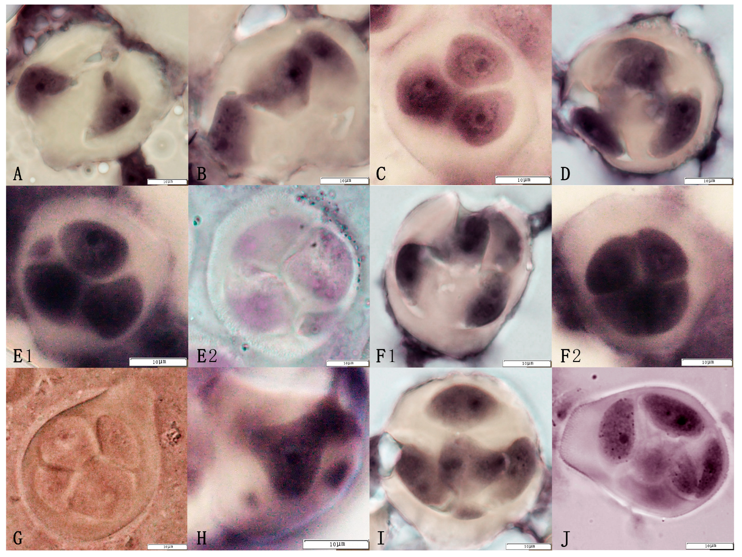 Plants 14 01643 g004