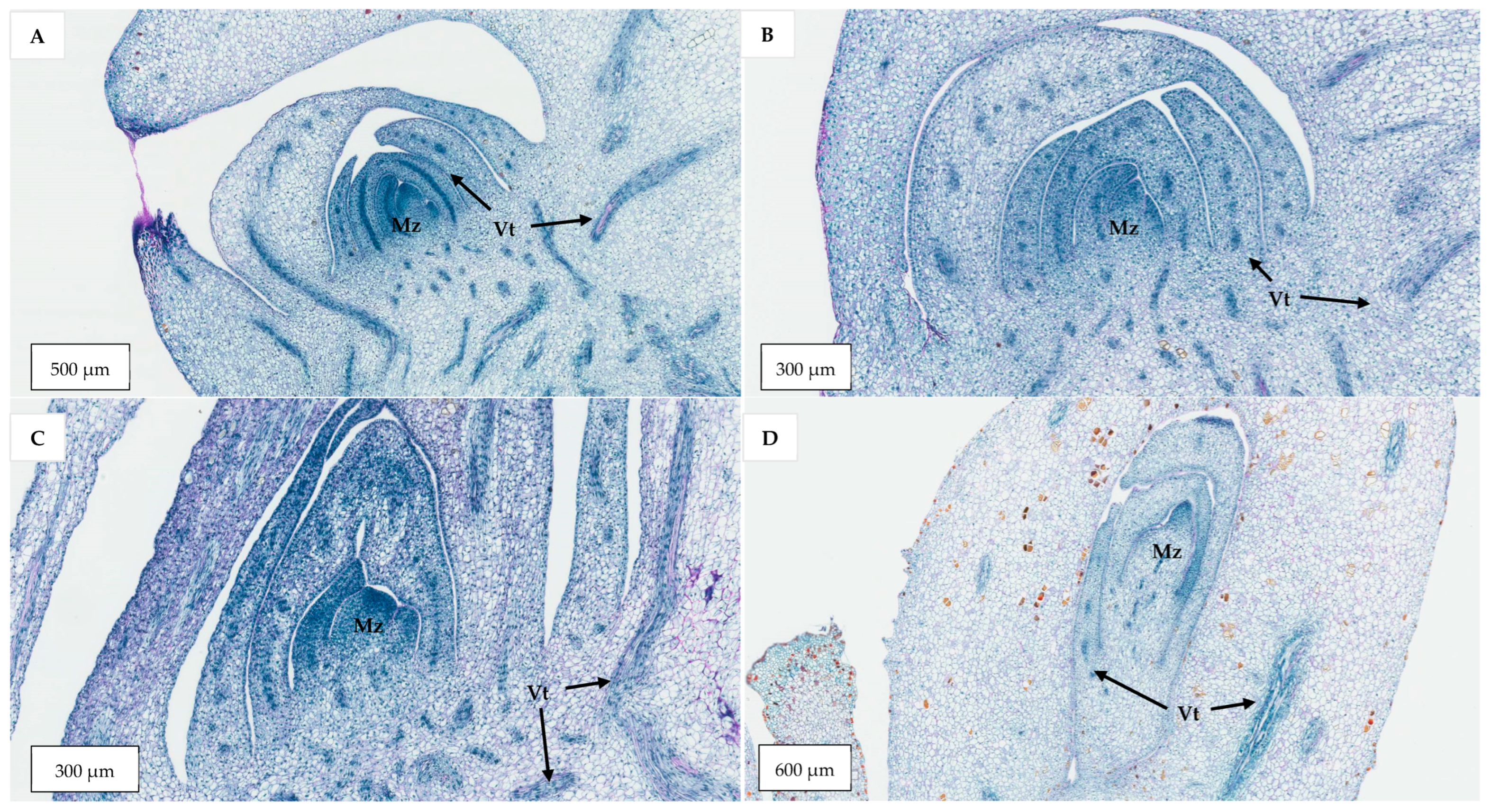 Plants 14 03123 g012