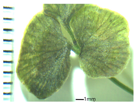 Asplenium yishuiensis (Aspleniaceae), a New Wintergreen and